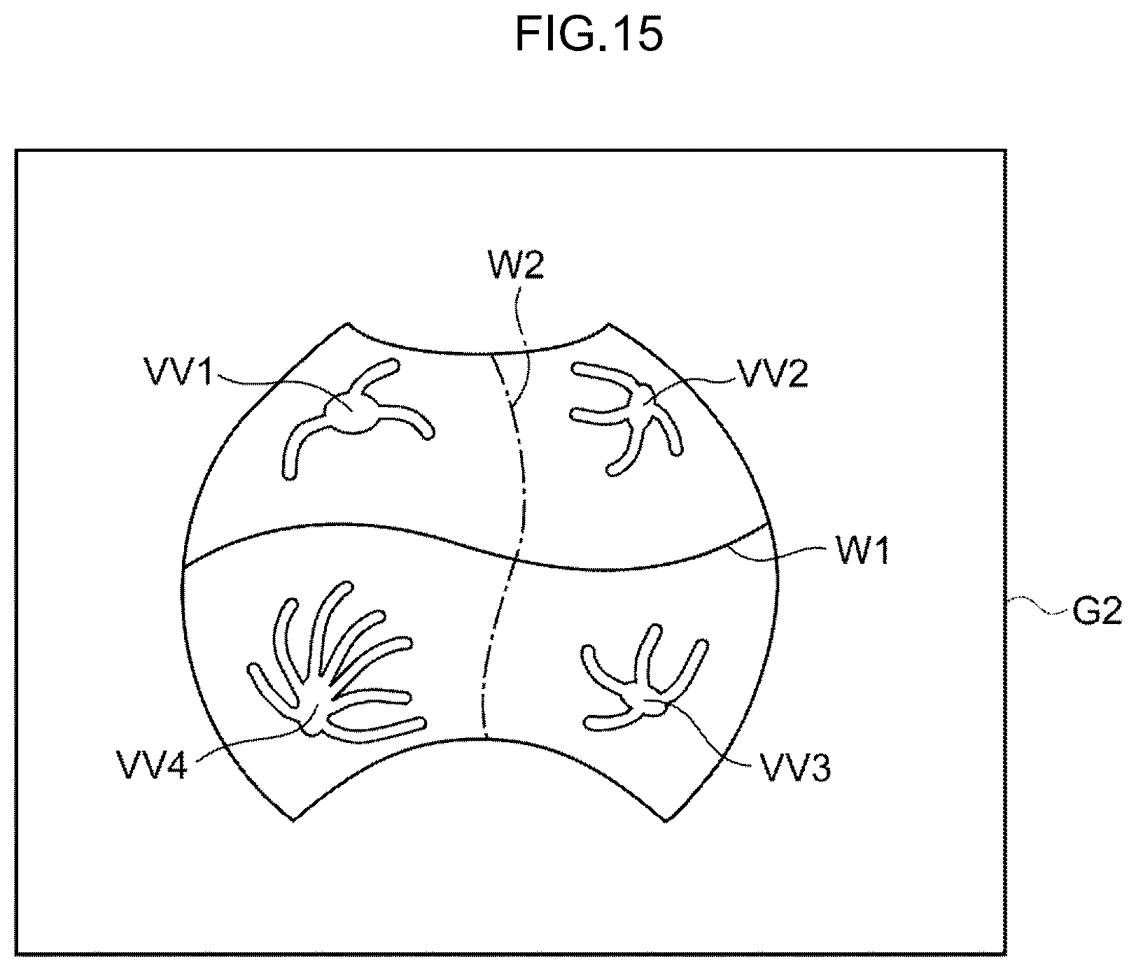 Patent US12396642 Figure 12 – Image processing method, image processing device, and program