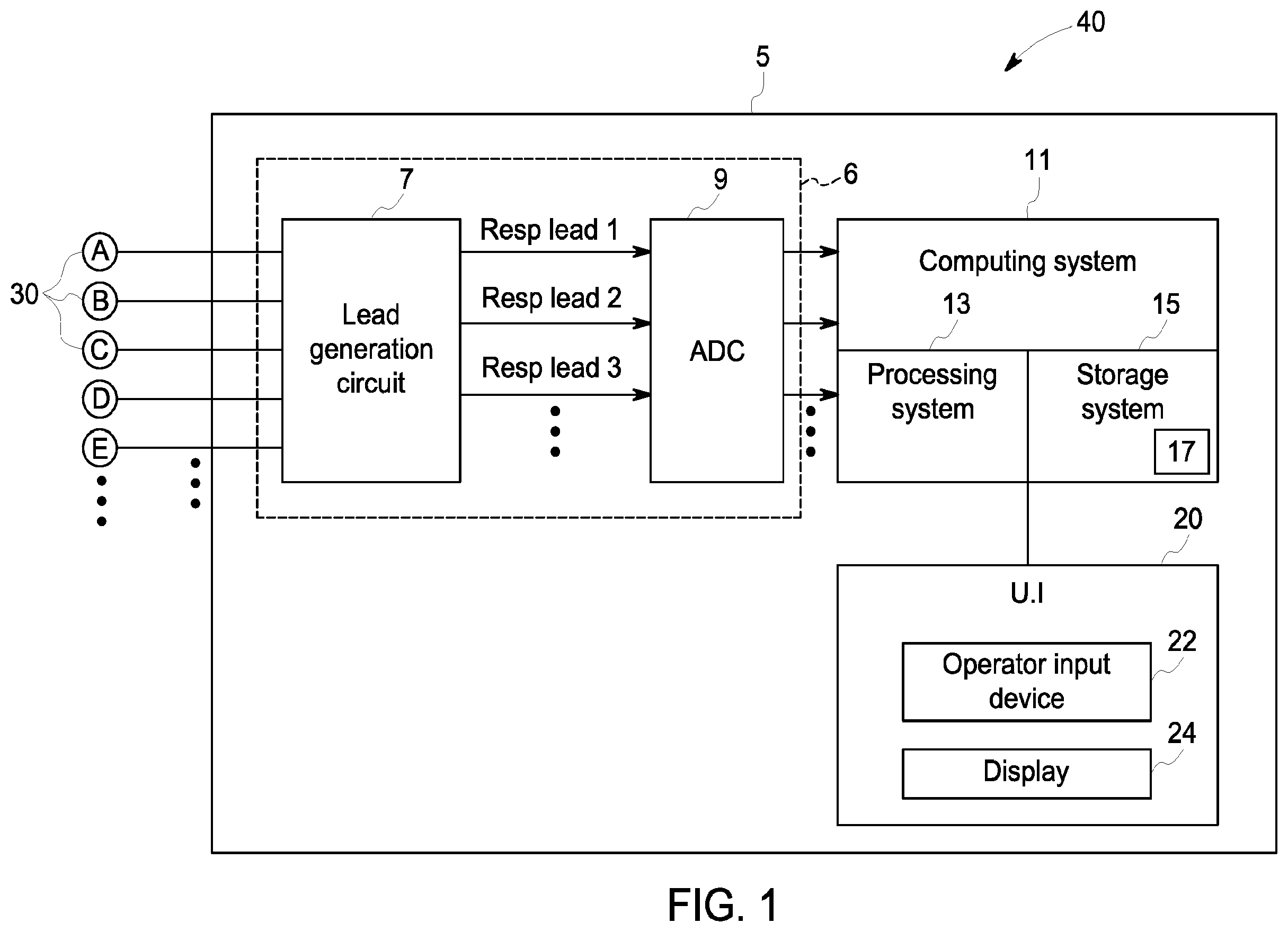 Patent US12396658 — System and method for apnea detection — Figure 1