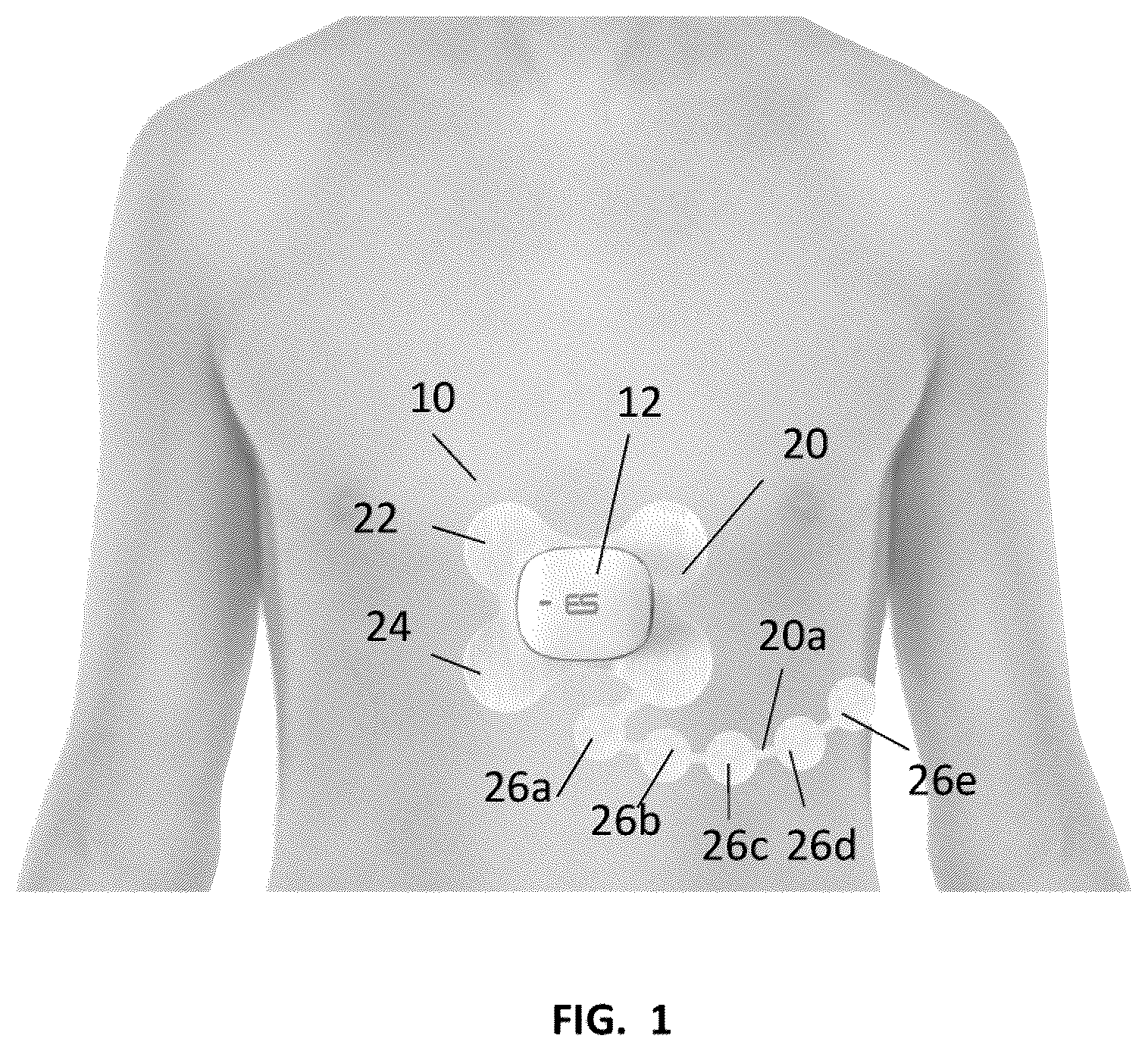 Patent US12396671 — ECG monitor device with electrode pad — Figure 1