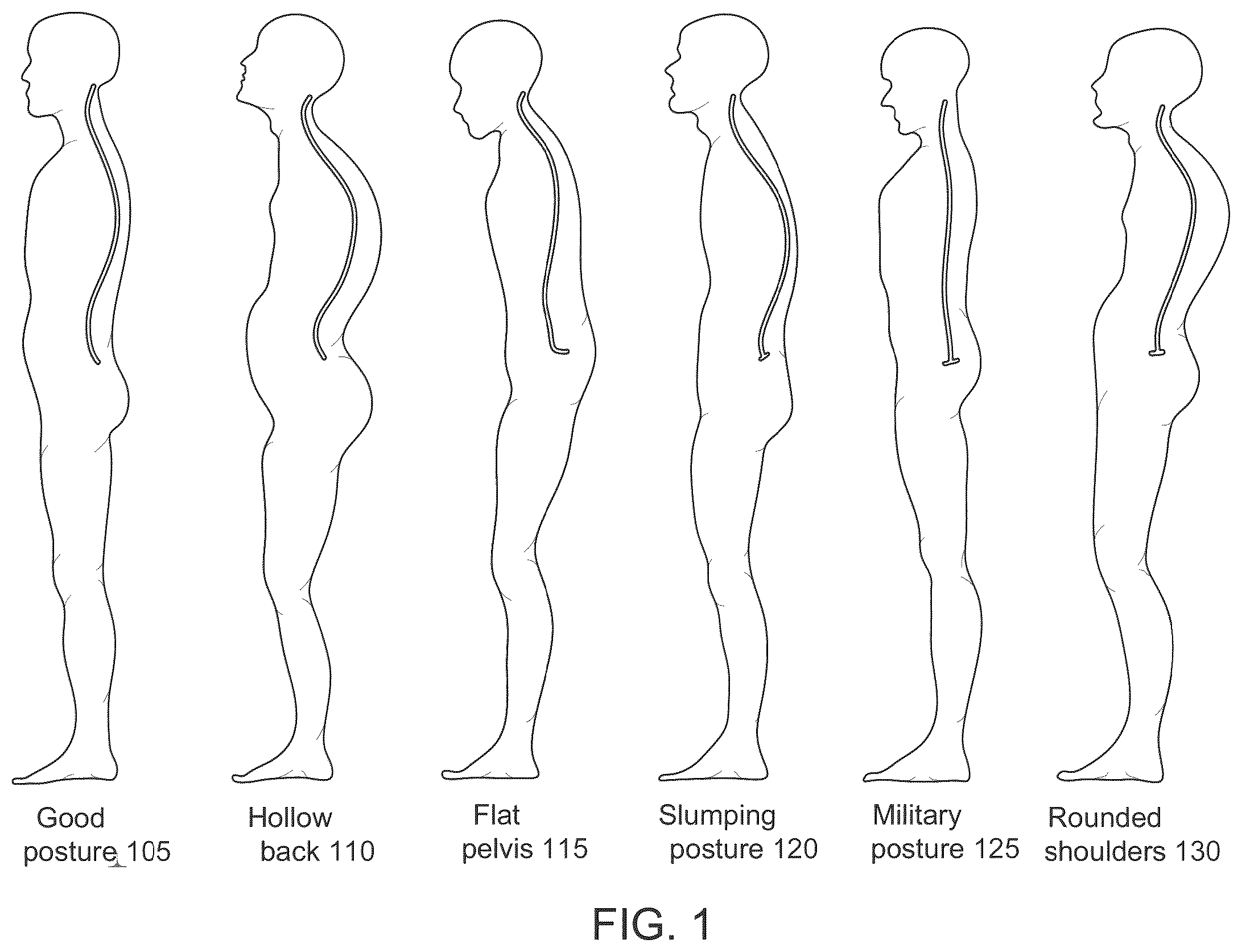 Patent US12396676 — System and method for automated diagnosis of musculoskeletal and neurological disorders — Figure 1