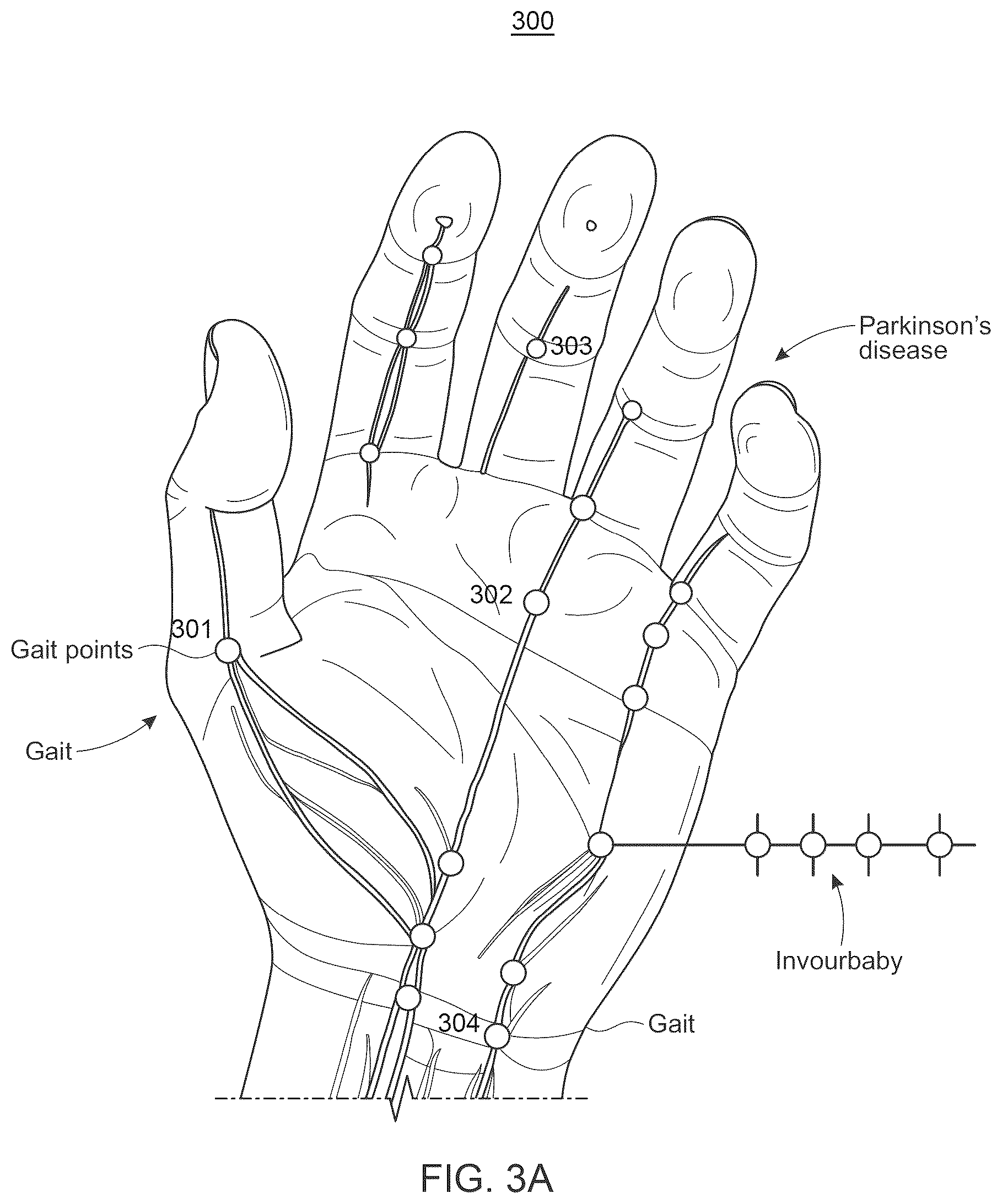 Patent US12396676 Figure 3 – System and method for automated diagnosis of musculoskeletal and neurological disorders