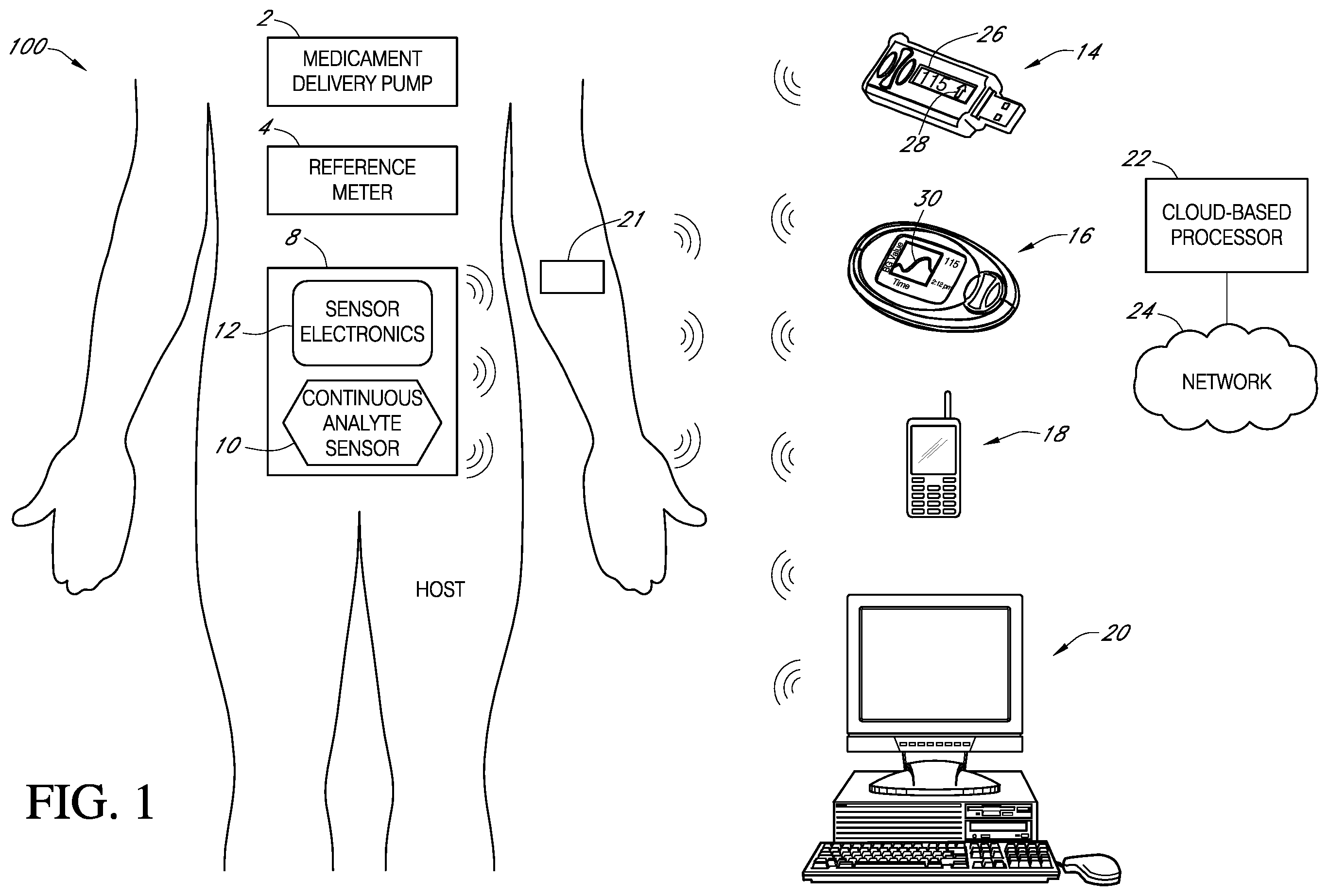 Patent US12396682 Figure 1 – Systems and methods for securing a continuous analyte sensor to a host