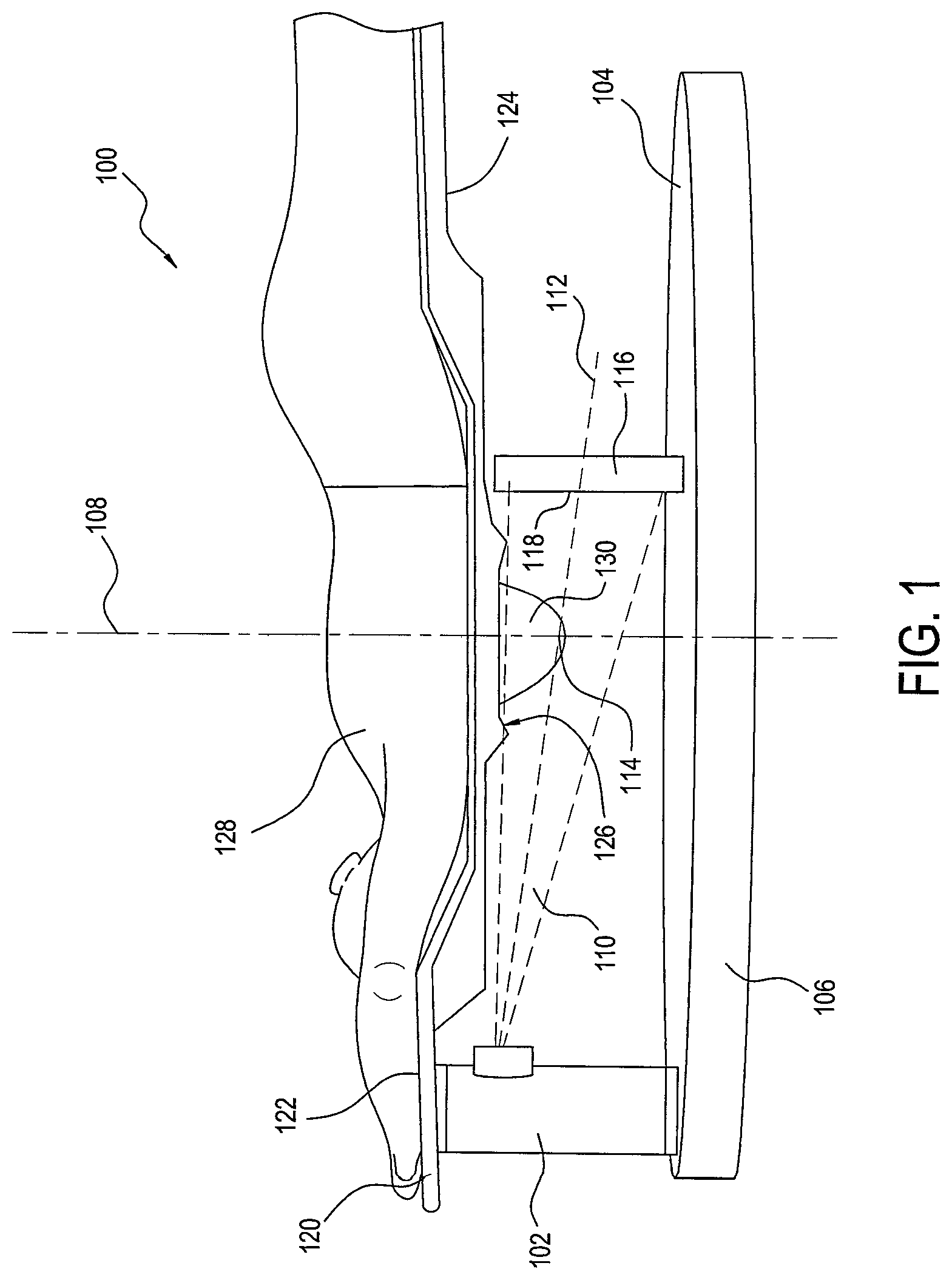 Patent US12396694 Figure 1 – Stationary detail imaging in cone beam breast computed tomography