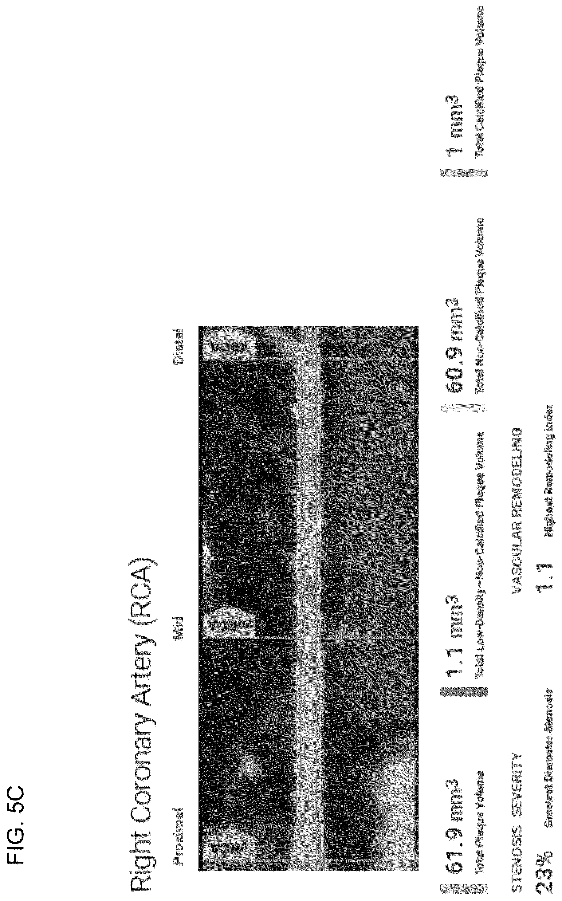 Patent US12396695 Figure 13 – Systems, methods, and devices for medical image analysis, diagnosis, risk stratification, decision making and/or disease tracking