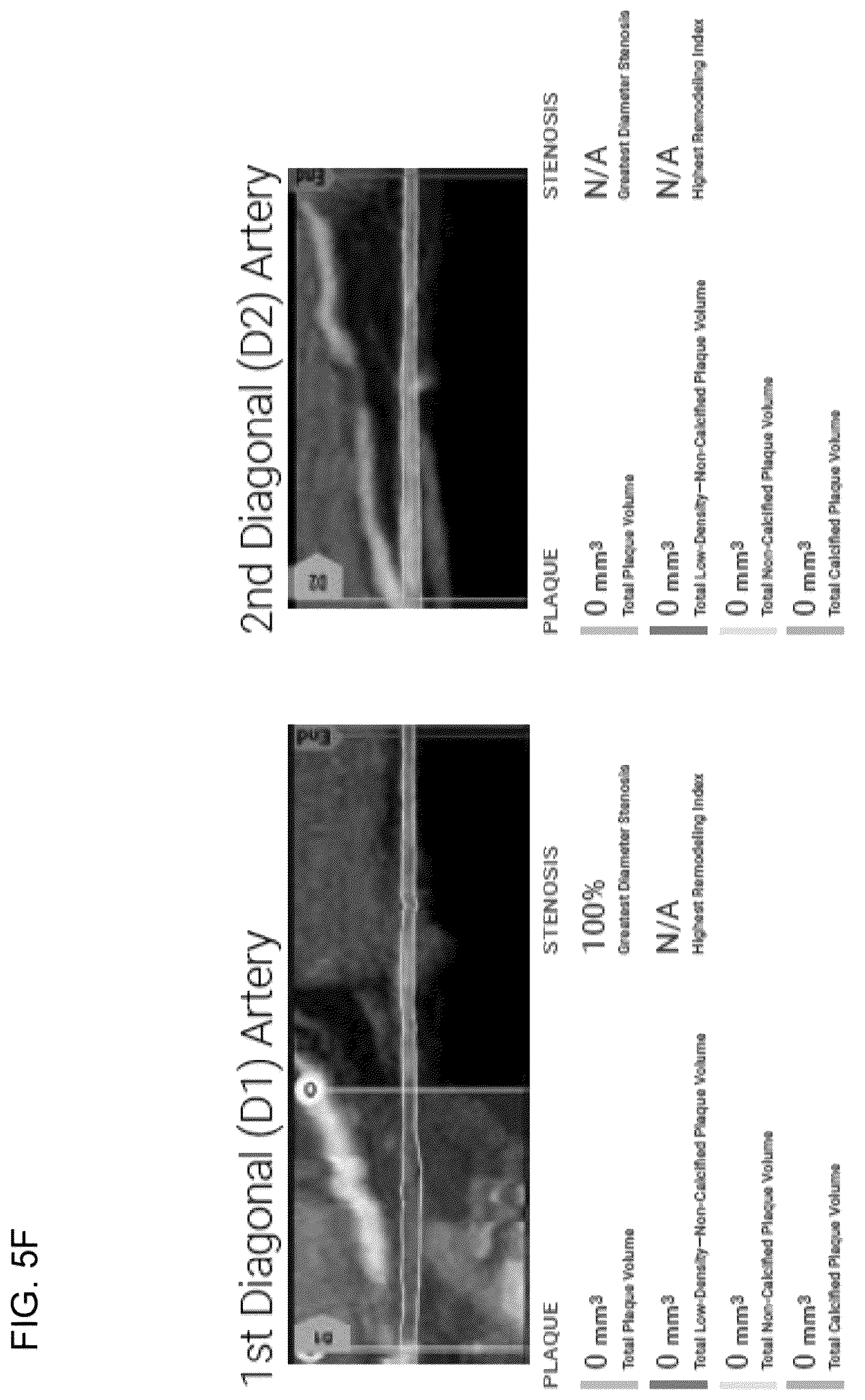 Patent US12396695 Figure 16 – Systems, methods, and devices for medical image analysis, diagnosis, risk stratification, decision making and/or disease tracking