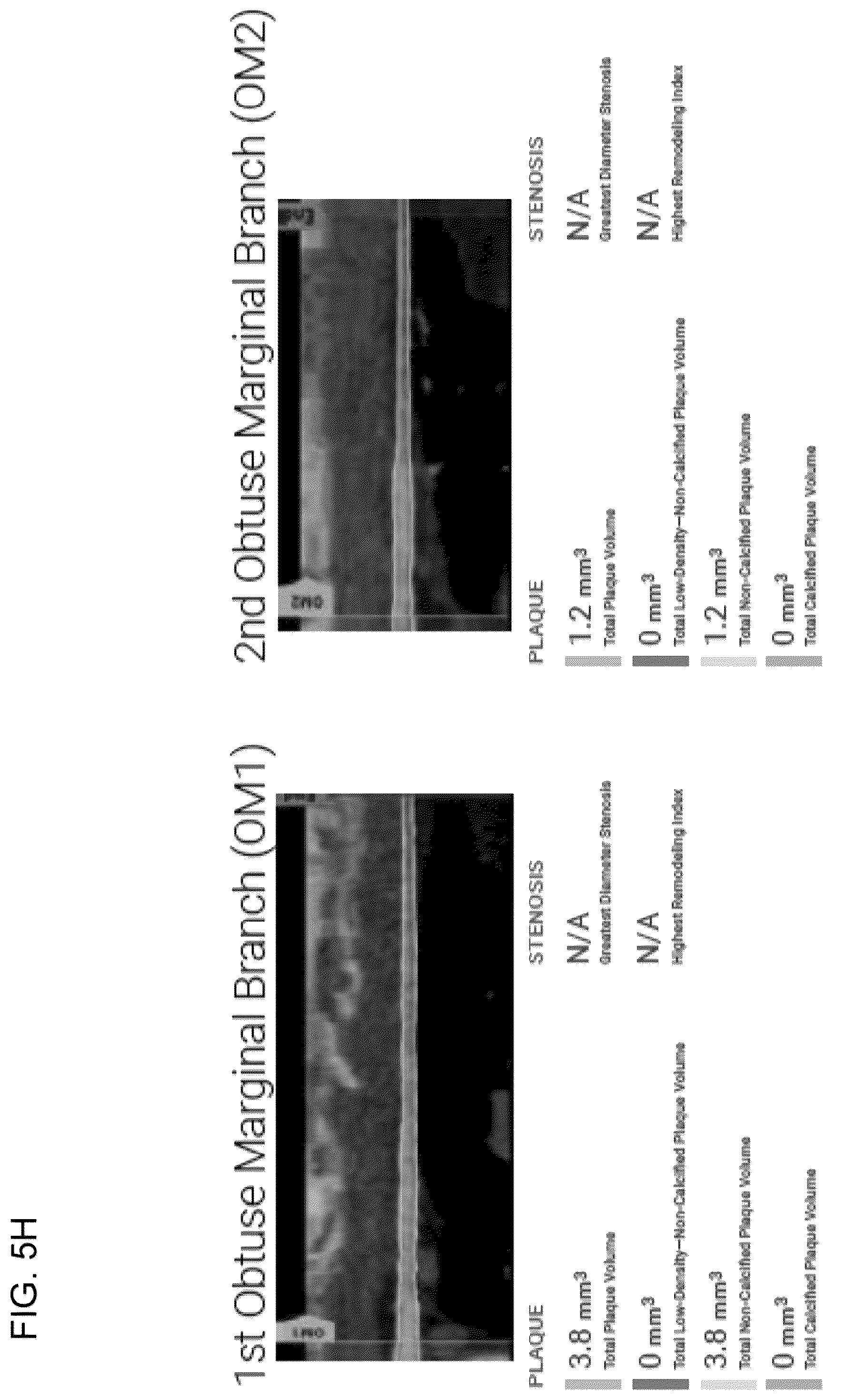 Patent US12396695 Figure 18 – Systems, methods, and devices for medical image analysis, diagnosis, risk stratification, decision making and/or disease tracking