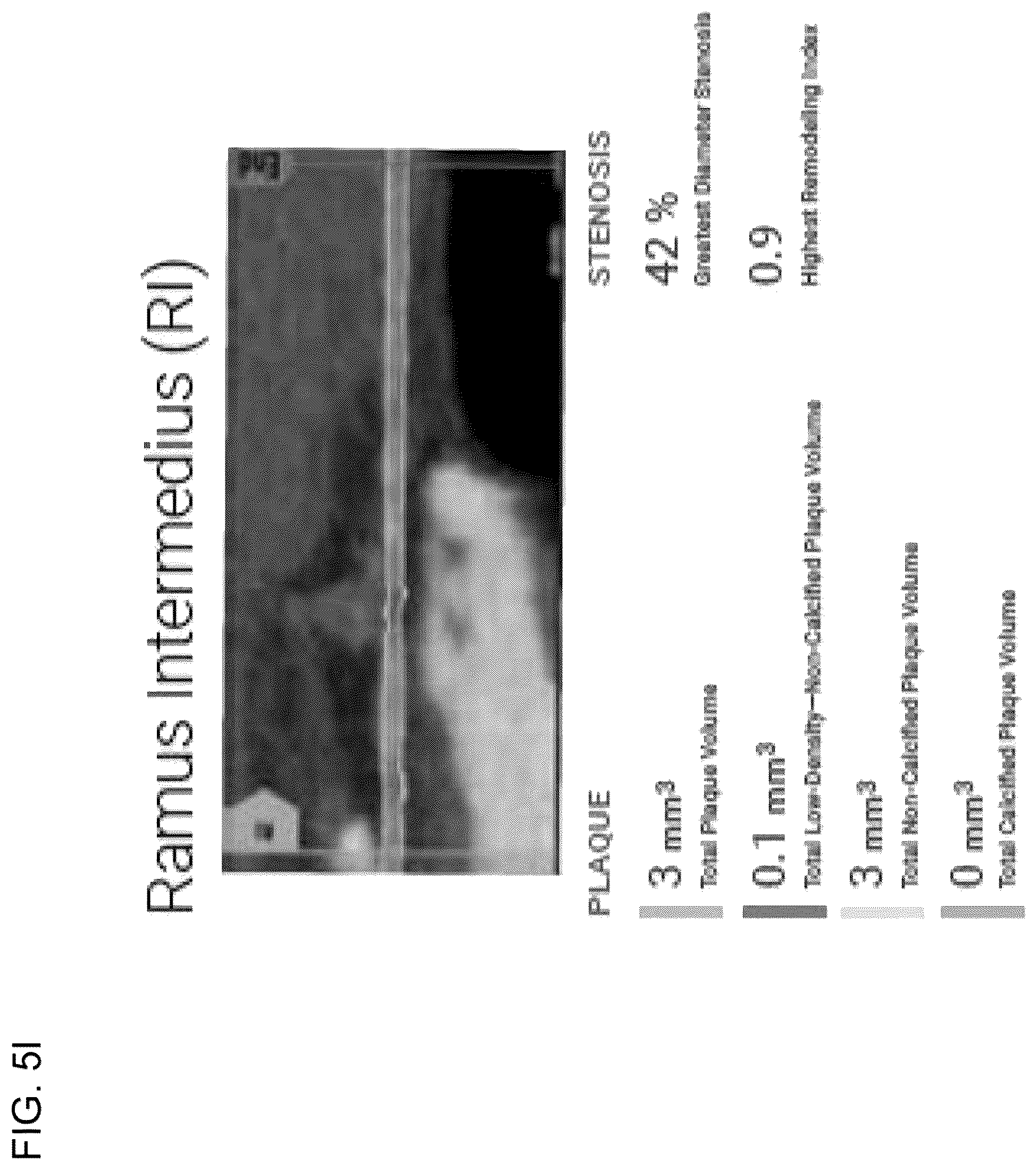 Patent US12396695 Figure 19 – Systems, methods, and devices for medical image analysis, diagnosis, risk stratification, decision making and/or disease tracking