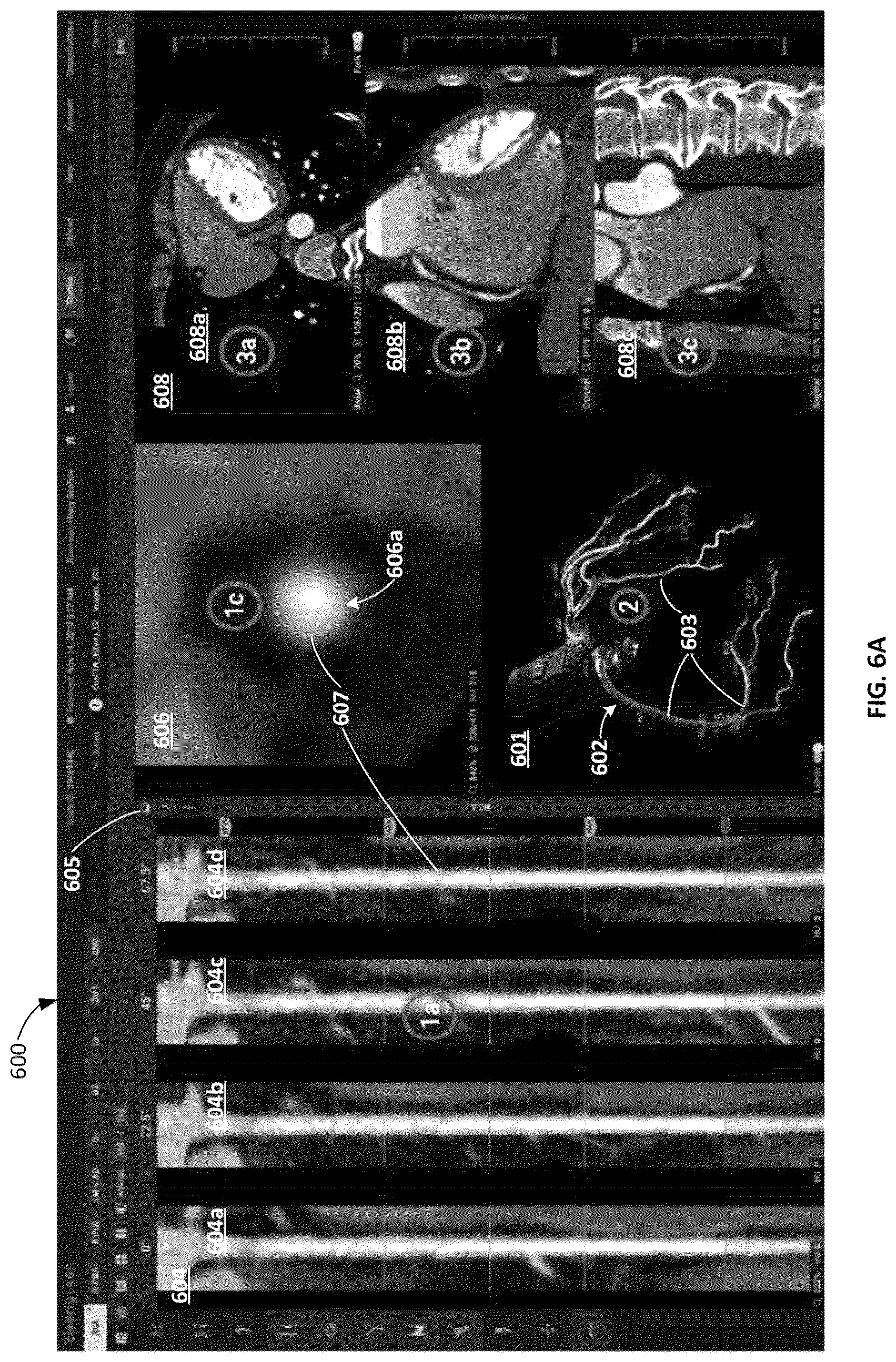 Patent US12396695 Figure 20 – Systems, methods, and devices for medical image analysis, diagnosis, risk stratification, decision making and/or disease tracking