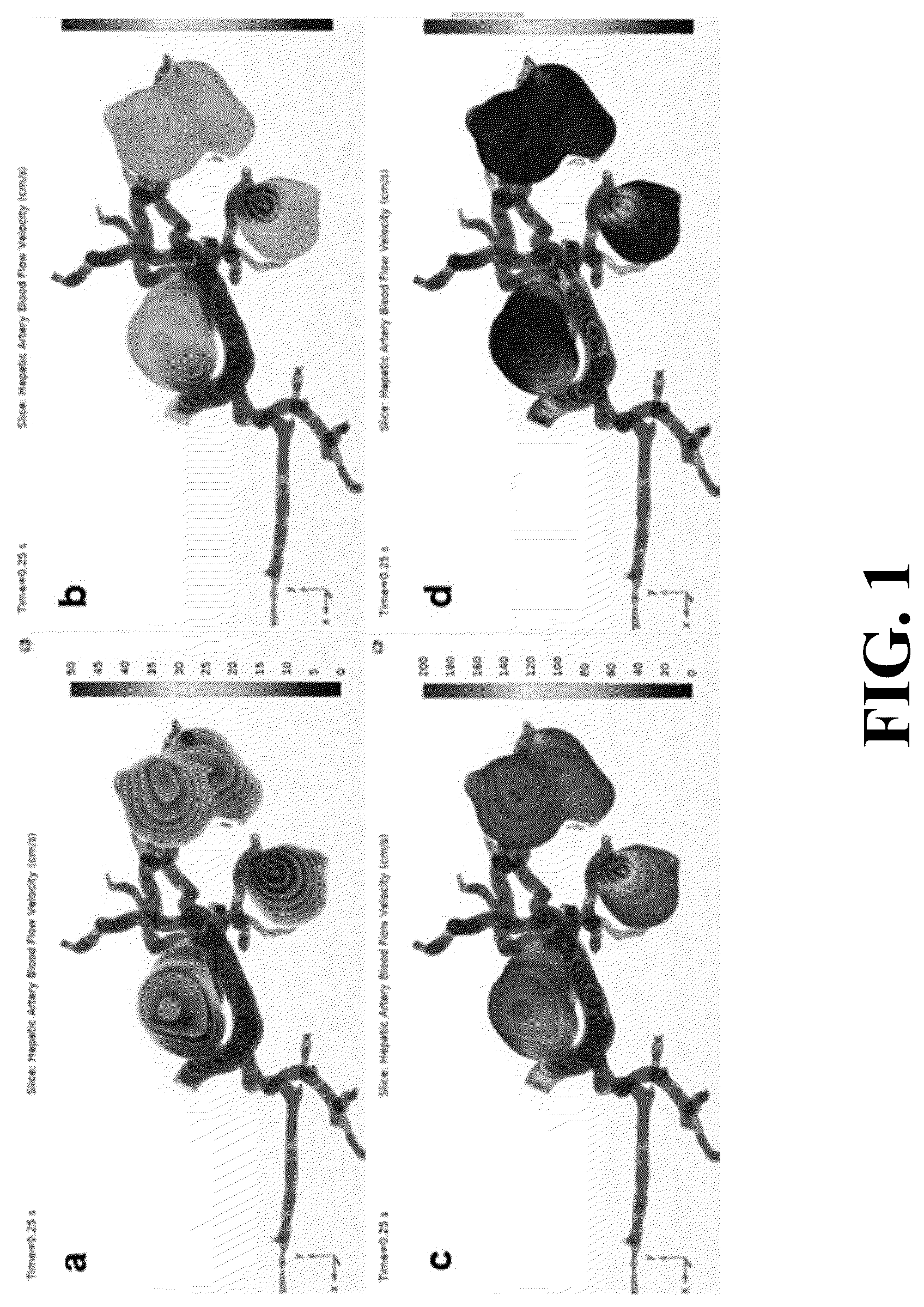 Patent US12396696 Figure 1 – Physiological modeling of multiphase intra-arterial CT angiography for hepatic embolization therapy