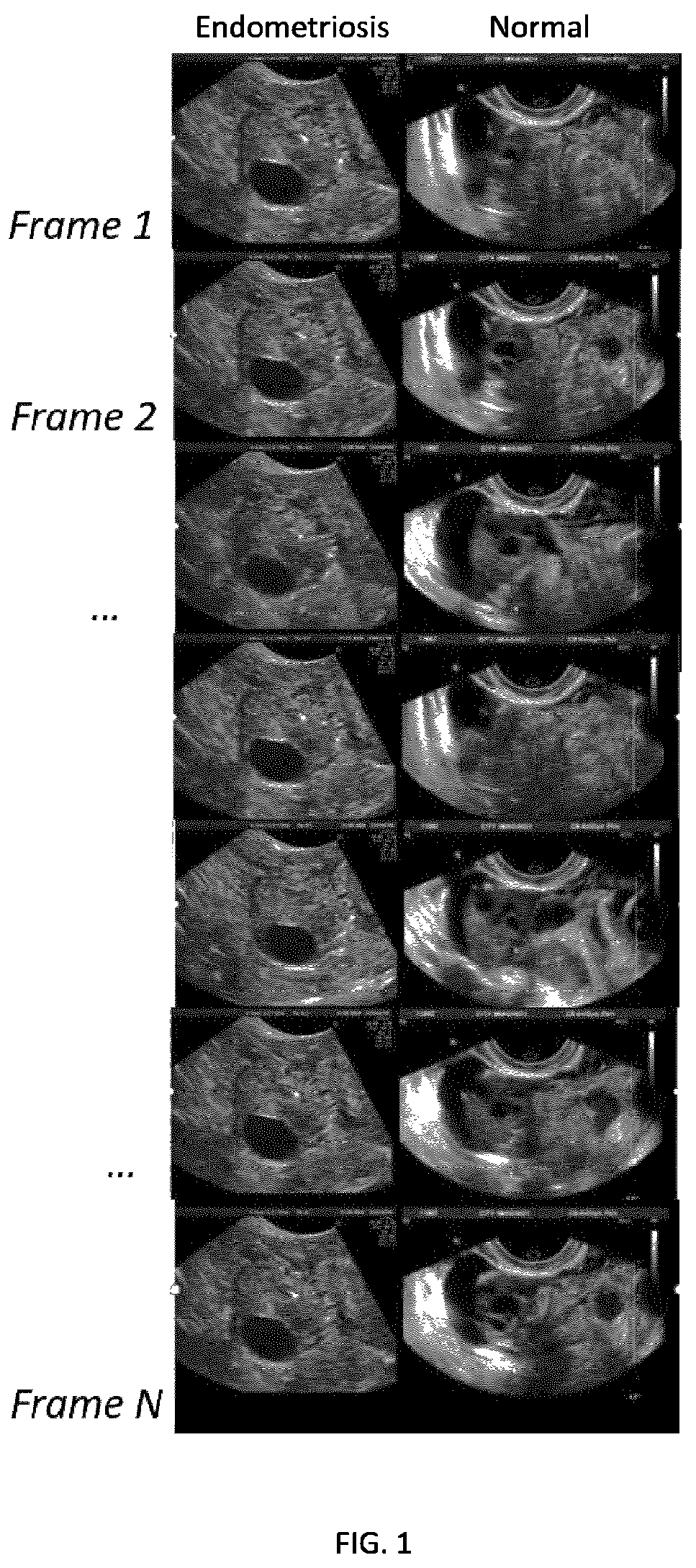 Patent US12396702 — Systems, methods, and apparatuses for quantitative assessment of organ mobility — Figure 1