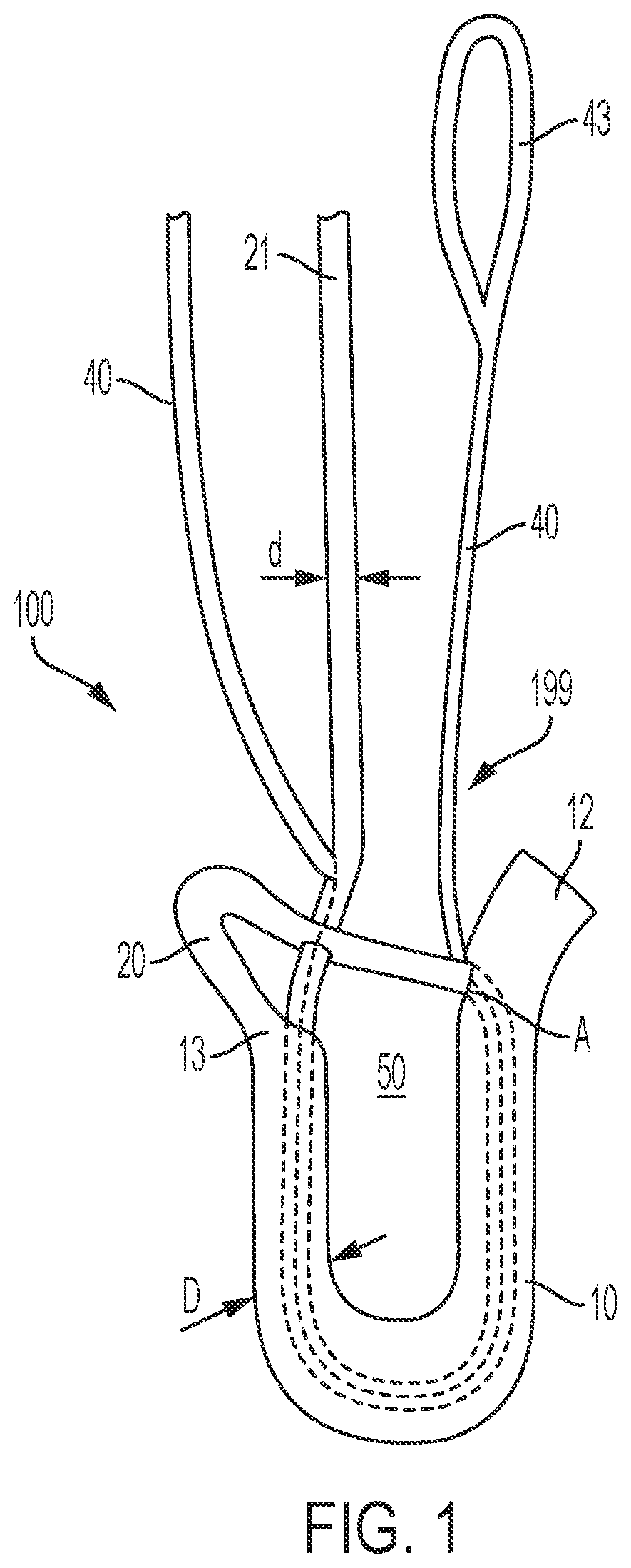 Patent US12396715 — Tensionable knotless anchors and methods of tissue repair — Figure 1