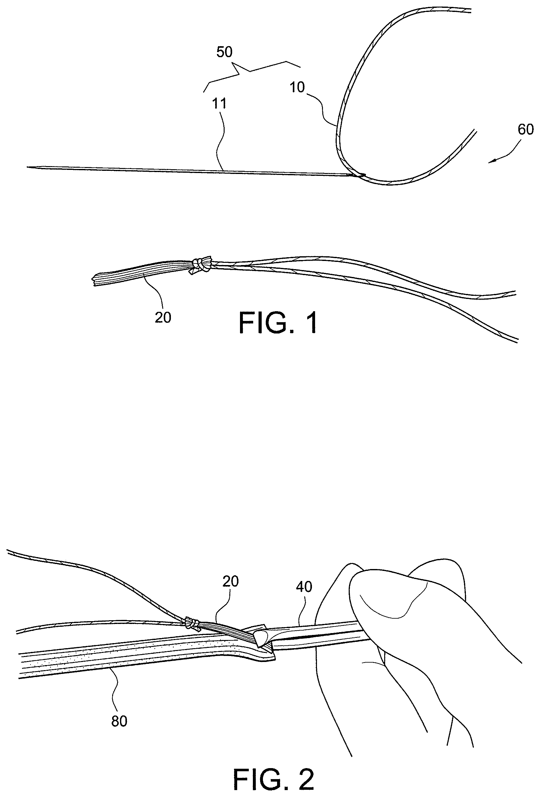 Patent US12396717 Figure 1 – Methods of making reinforced soft tissue grafts with suture loop/needle constructs