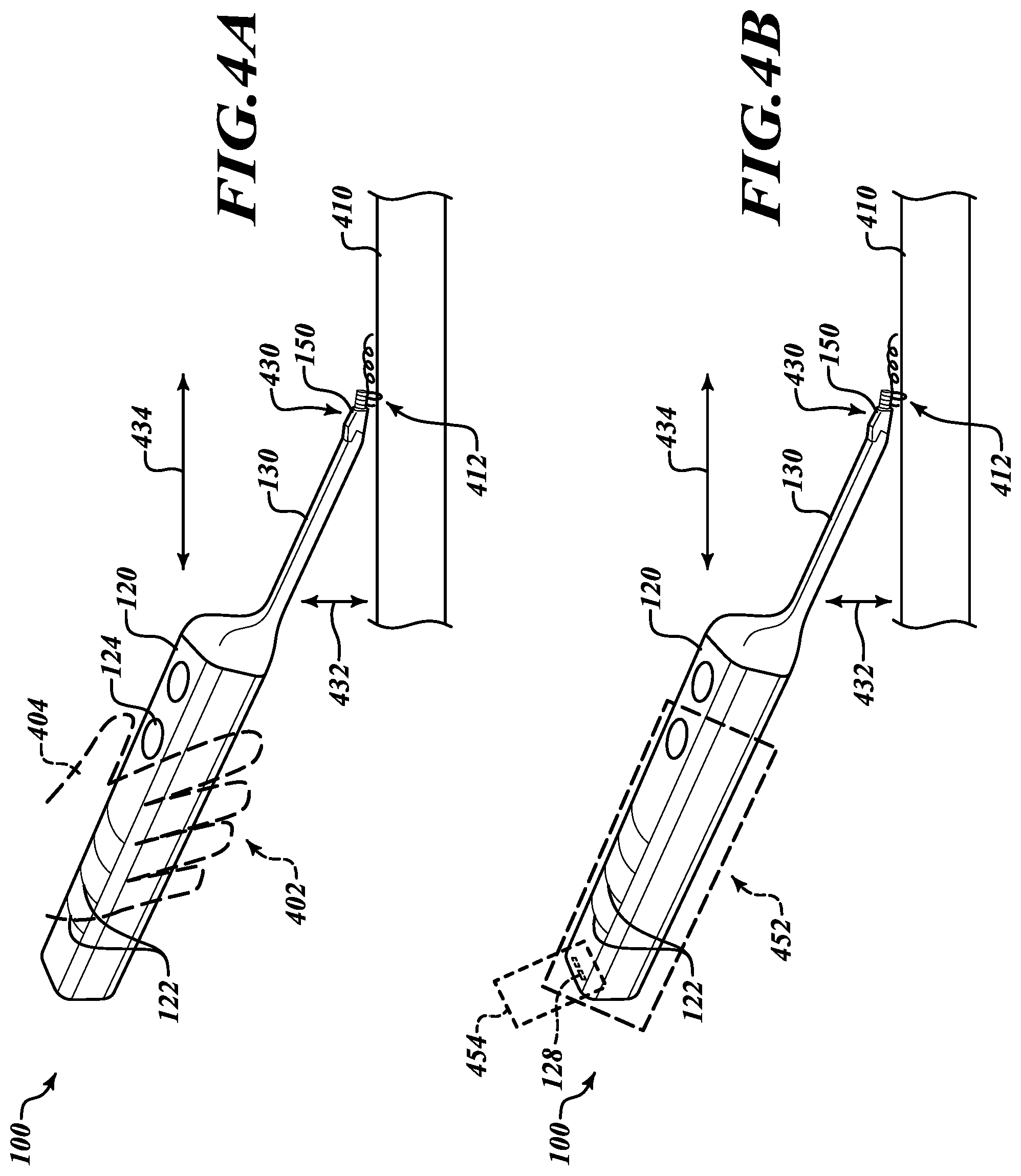Patent US12396721 Figure 4 – Movable suturing apparatus and method