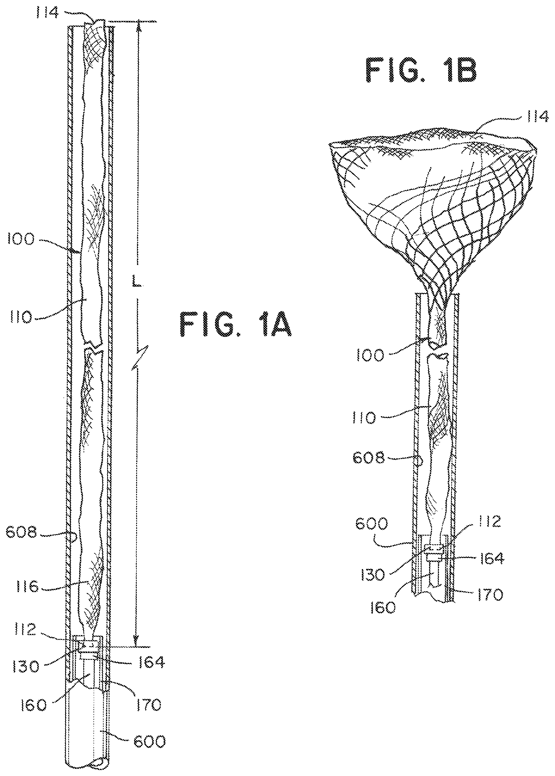 Patent US12396730 — Braided implant with detachment mechanism — Figure 1