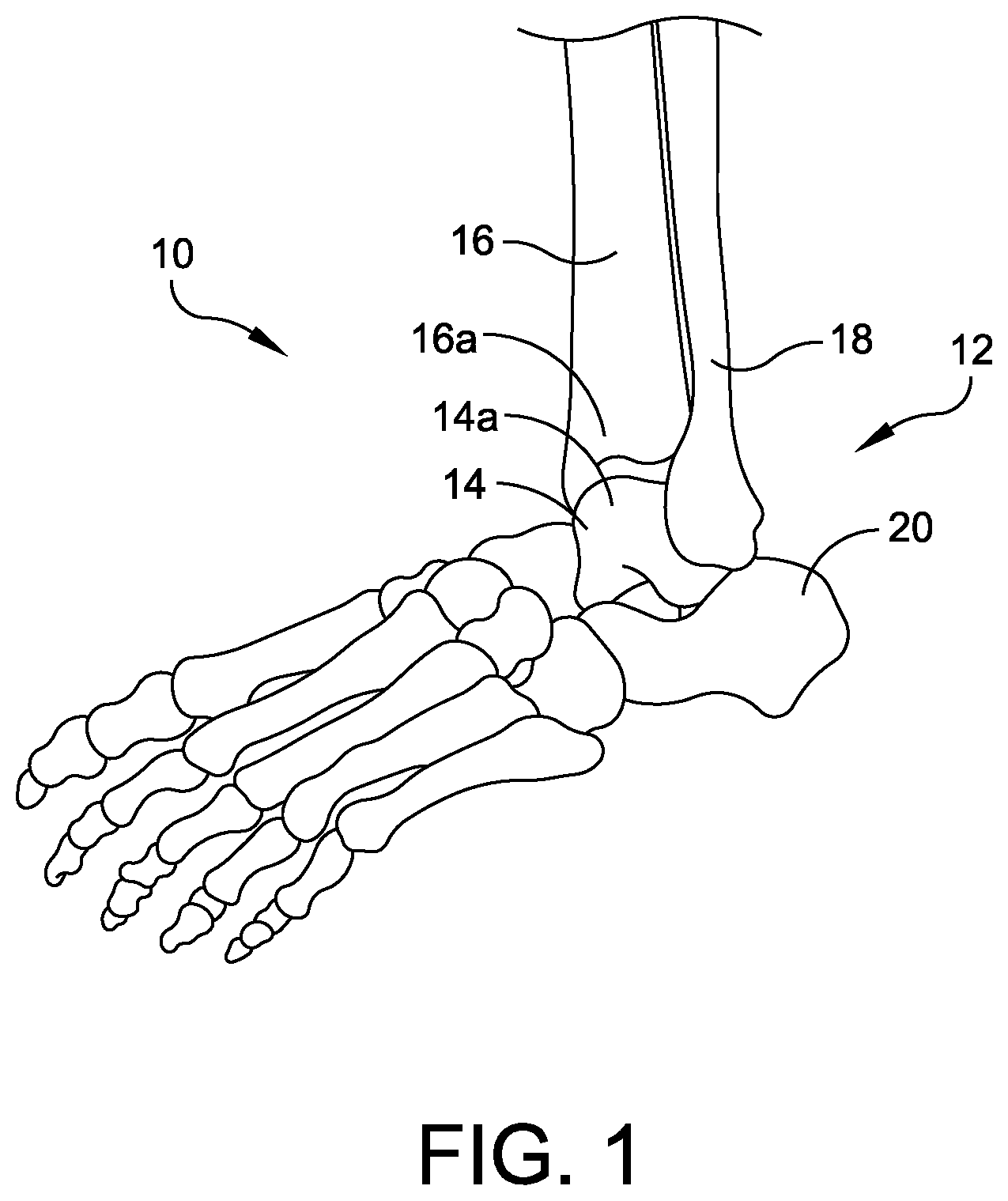 Patent US12396739 — Guidance tools, systems, and methods — Figure 1