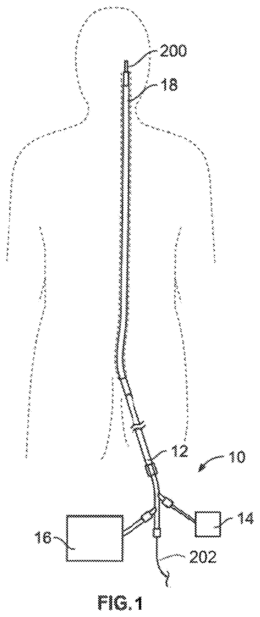 Patent US12396743 — Retrieval systems and methods for use thereof — Figure 1