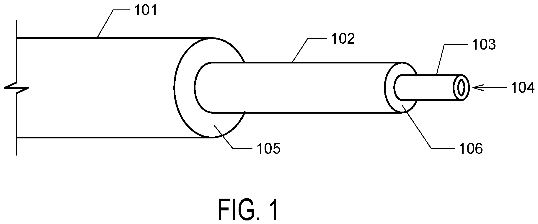 Patent US12396750 Figure 1 – Adjustable stepped cannula