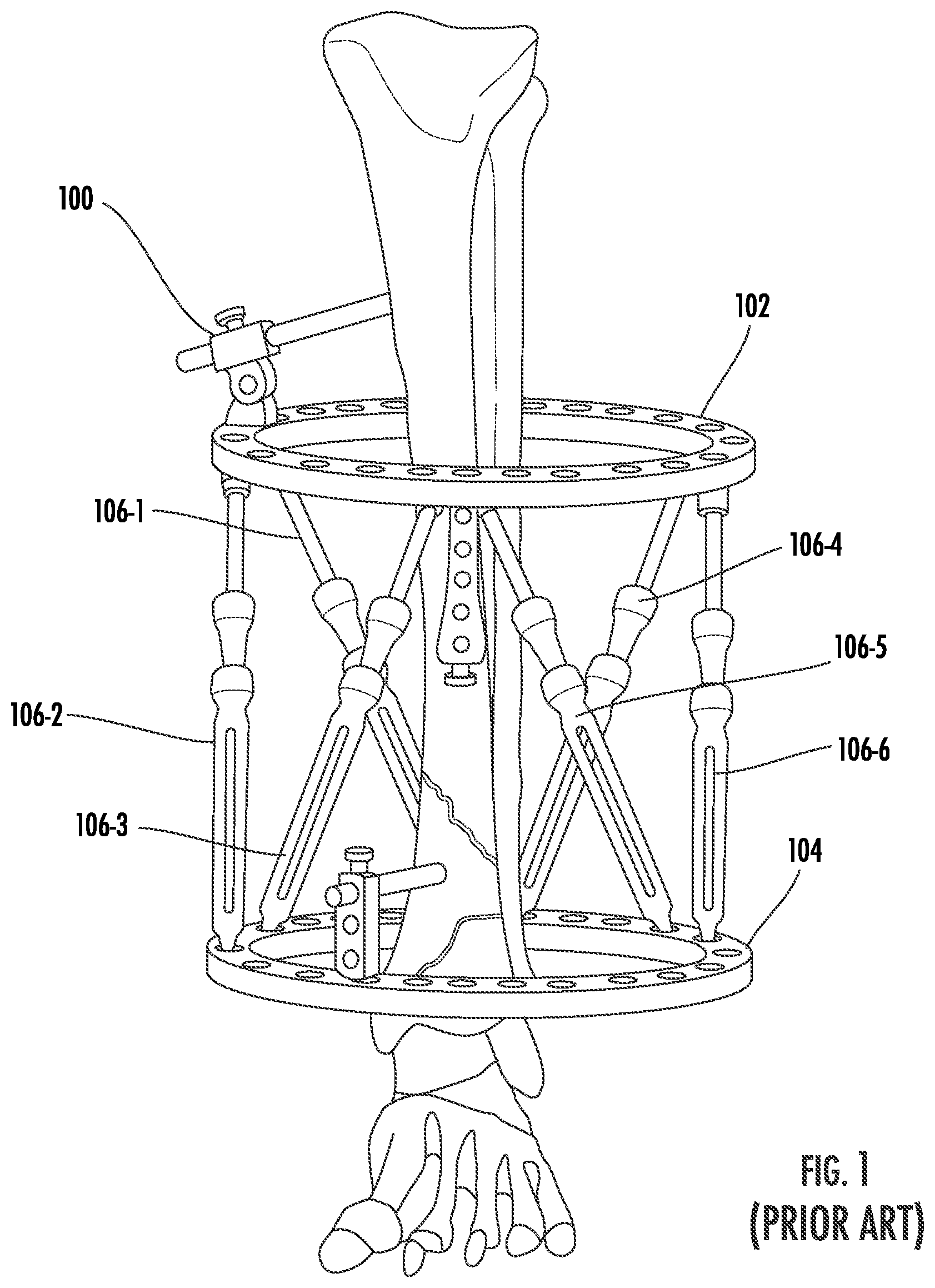 Patent US12396756 — Conversion kit for an external fixation system — Figure 1
