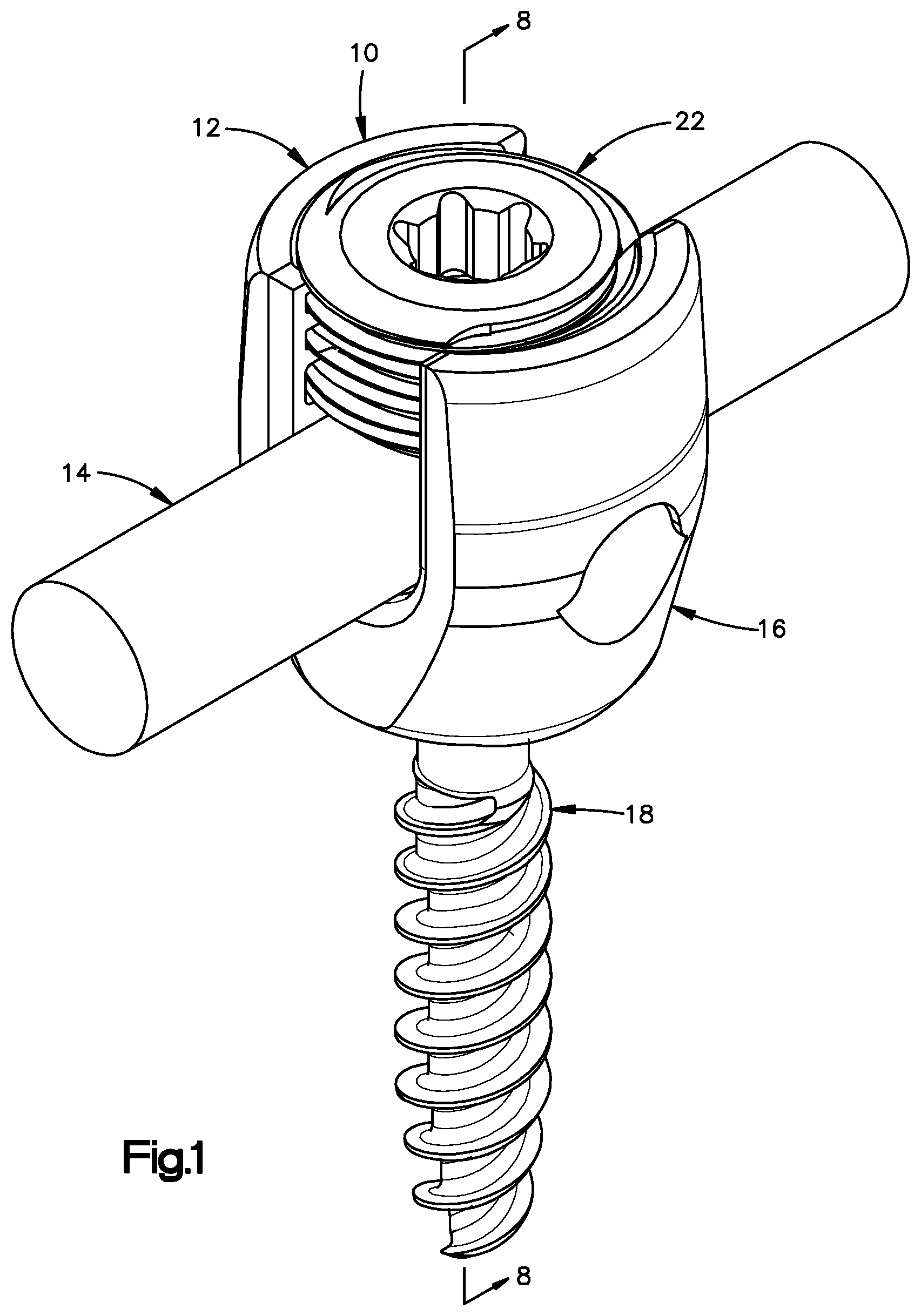 Patent US12396758 — Polyaxial bone fixation element — Figure 1
