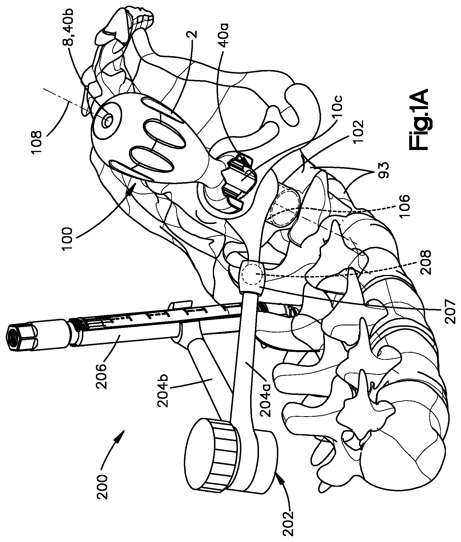 Patent US12396764 — Control member for adjusting access tube position, and related systems and methods — Figure 1