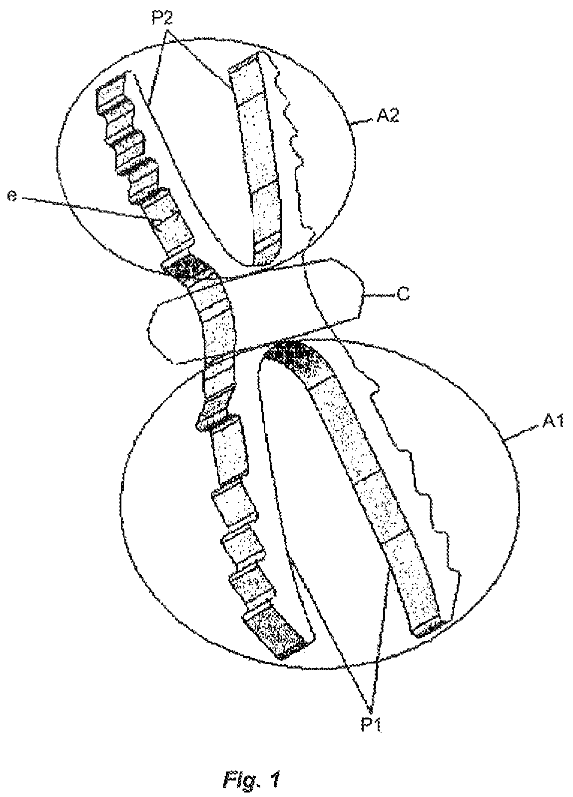 Patent US12396766 — Osteosynthesis device — Figure 1