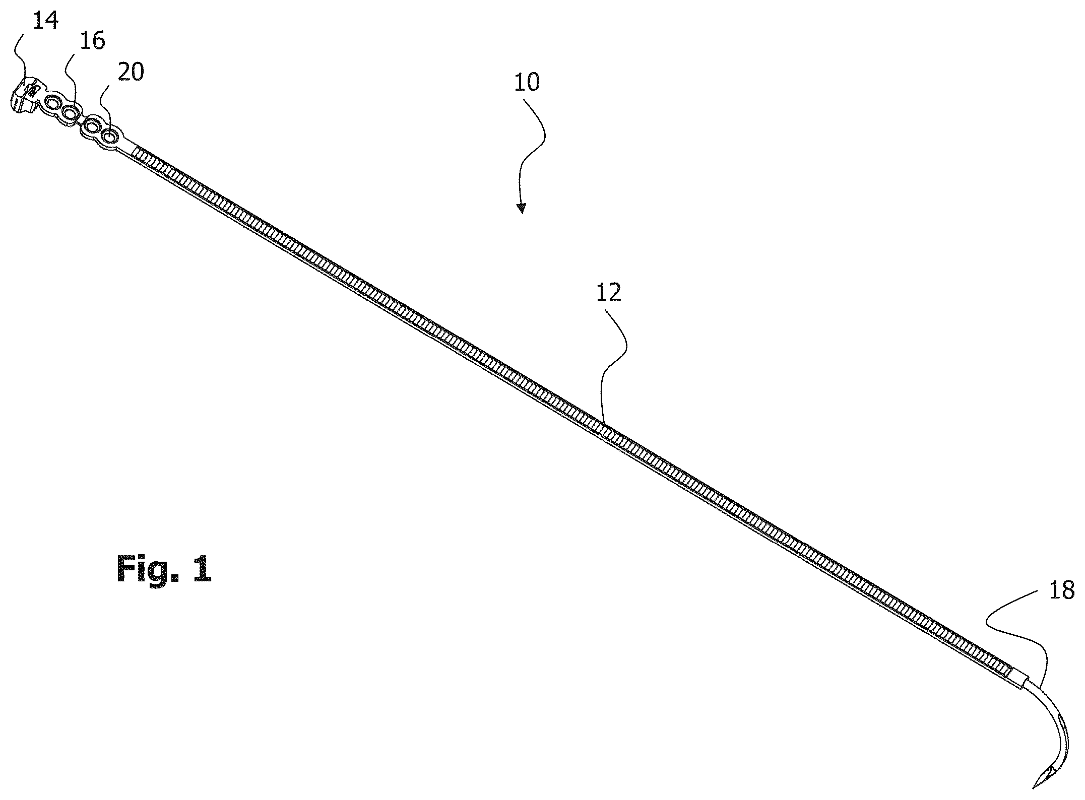 Patent US12396772 — Implant for bone fixation — Figure 1