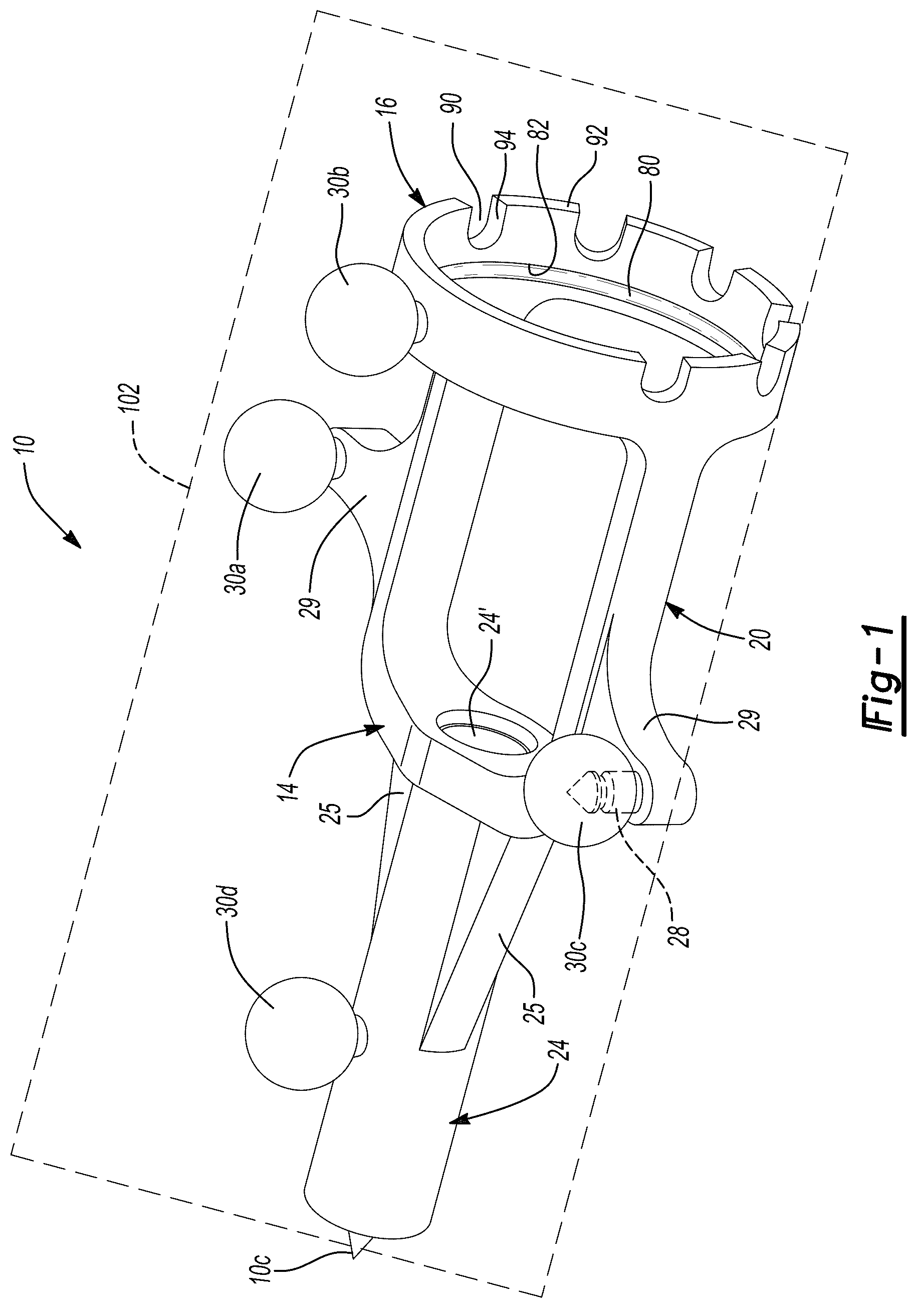 Patent US12396775 — System and method for positioning a tracking device — Figure 1