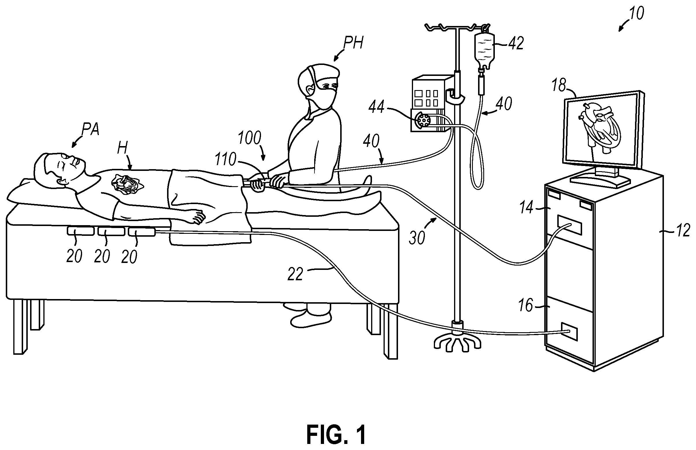 Patent US12396787 — Catheter with integrated thin-film microsensors — Figure 1