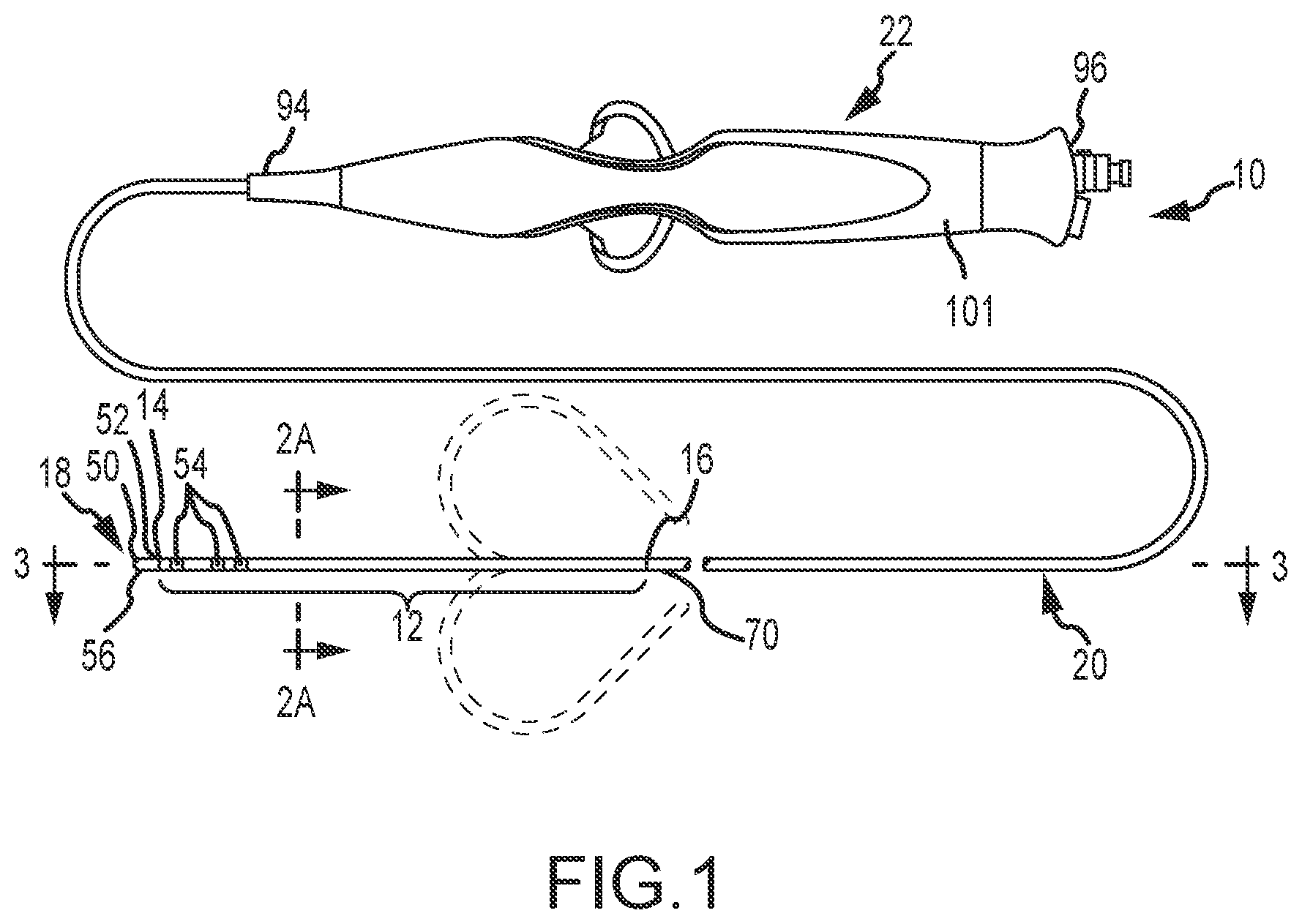 Patent US12396788 — Flex tip fluid lumen assembly with termination tube — Figure 1