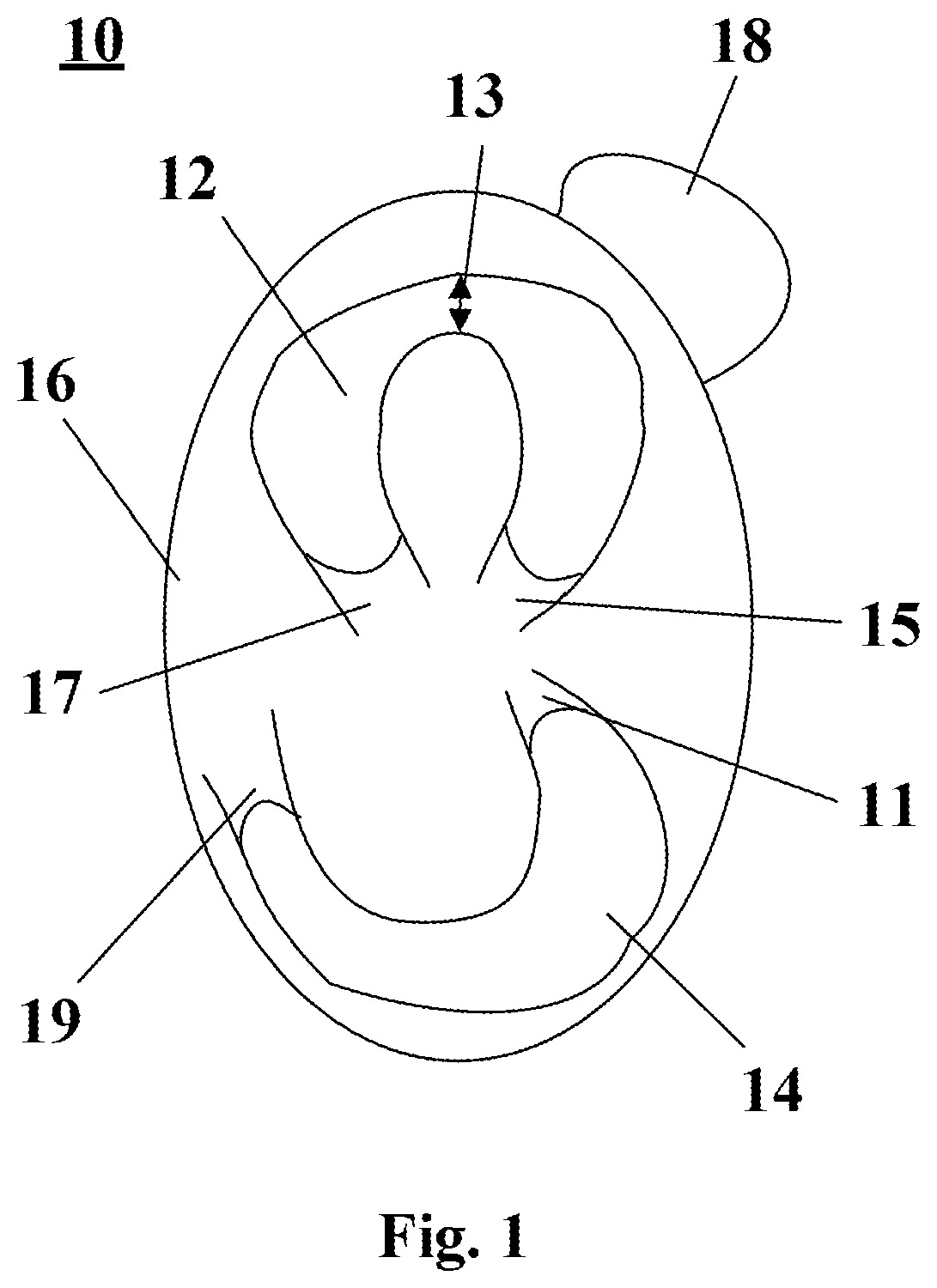 Patent US12396797 — System and methods of manufacturing a lateral meniscus implant — Figure 1
