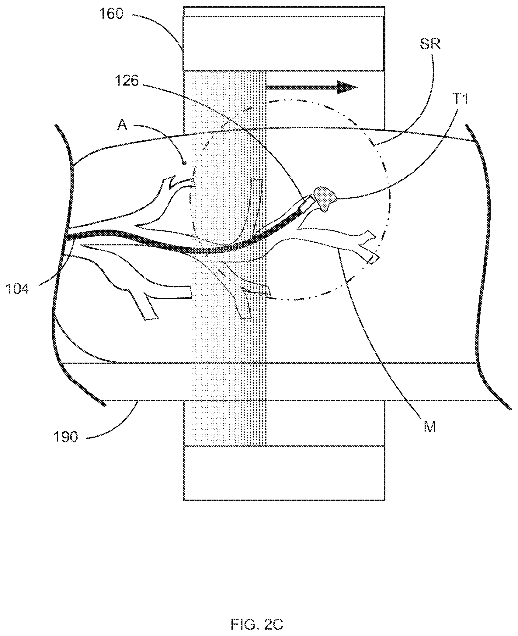 Patent US12396812 Figure 5 – Systems and methods for robotic medical system integration with external imaging