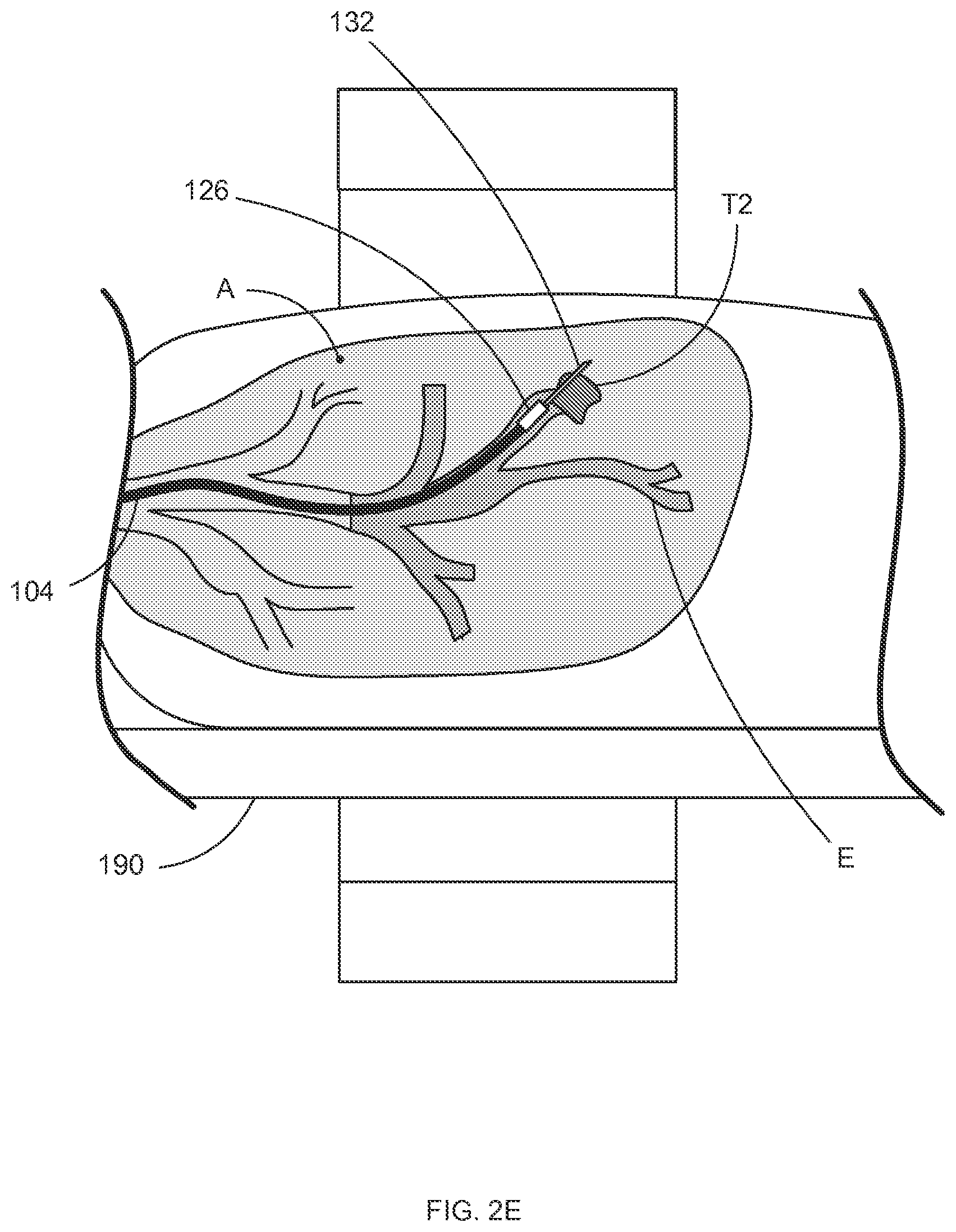 Patent US12396812 Figure 7 – Systems and methods for robotic medical system integration with external imaging