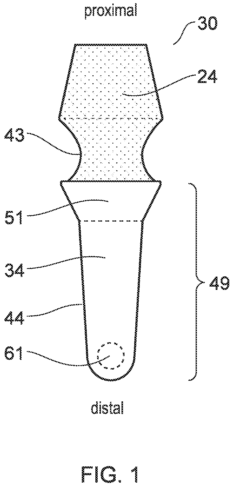 Patent US12396832 — Implant — Figure 1