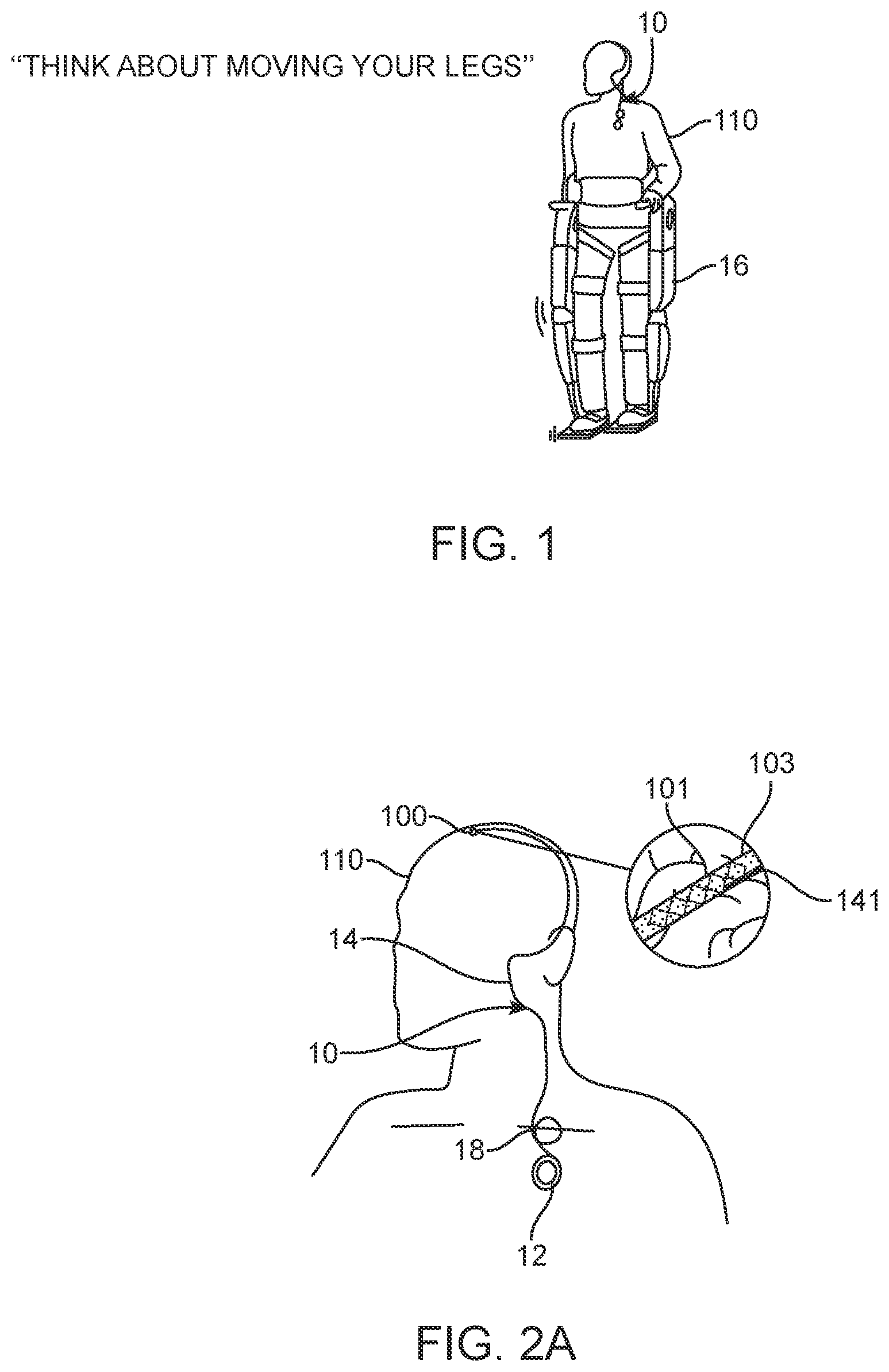 Patent US12396838 — Methods of transmitting neural activity — Figure 1