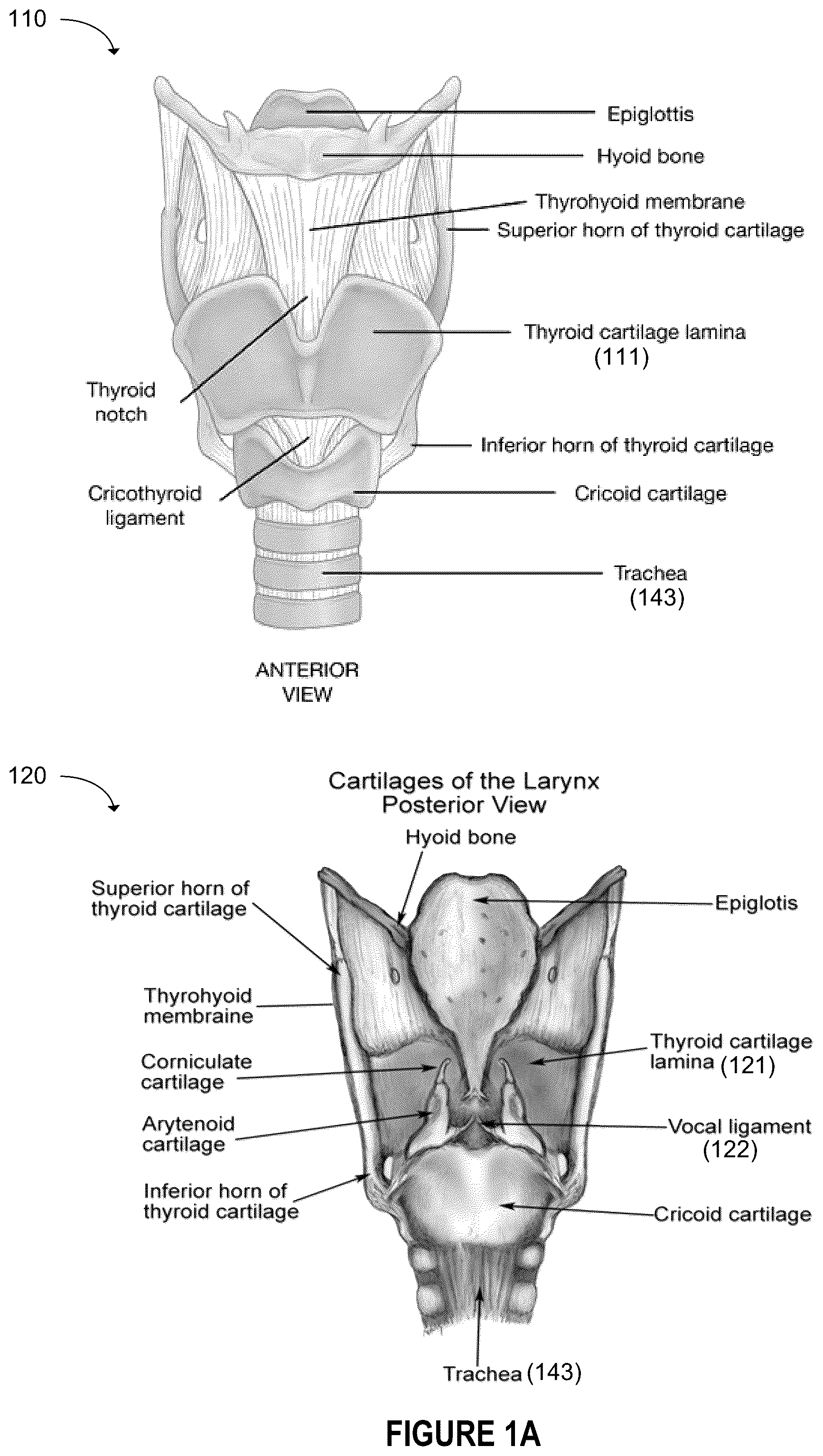 Patent US12396844 — Methods and apparatus for treating glottic insufficiency — Figure 1