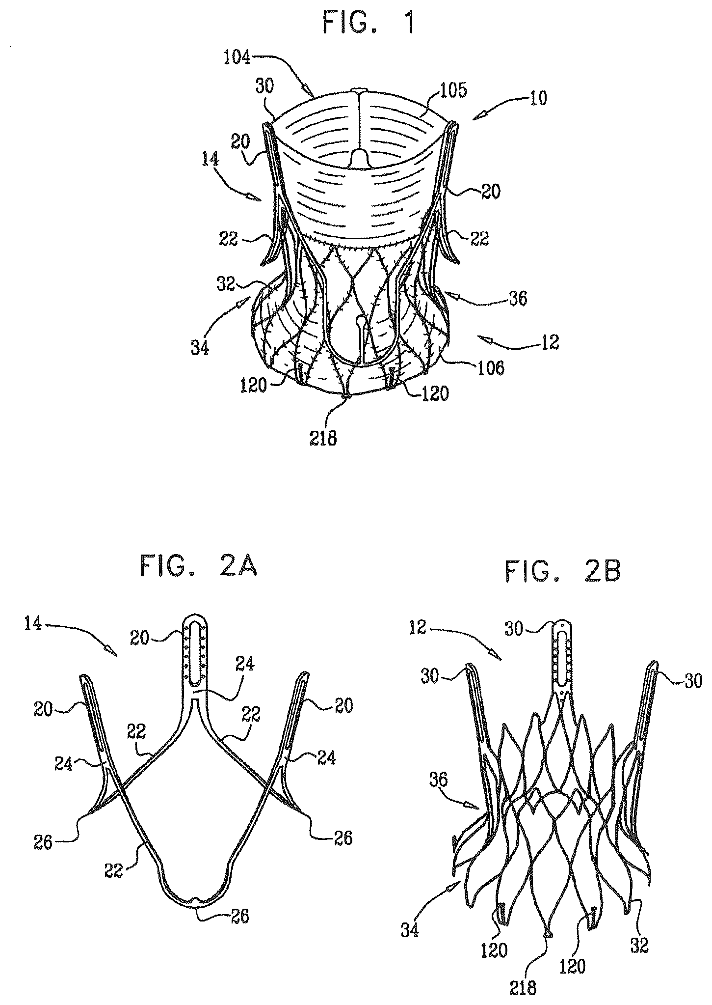 Patent US12396849 — Sinus-engaging valve fixation member — Figure 1