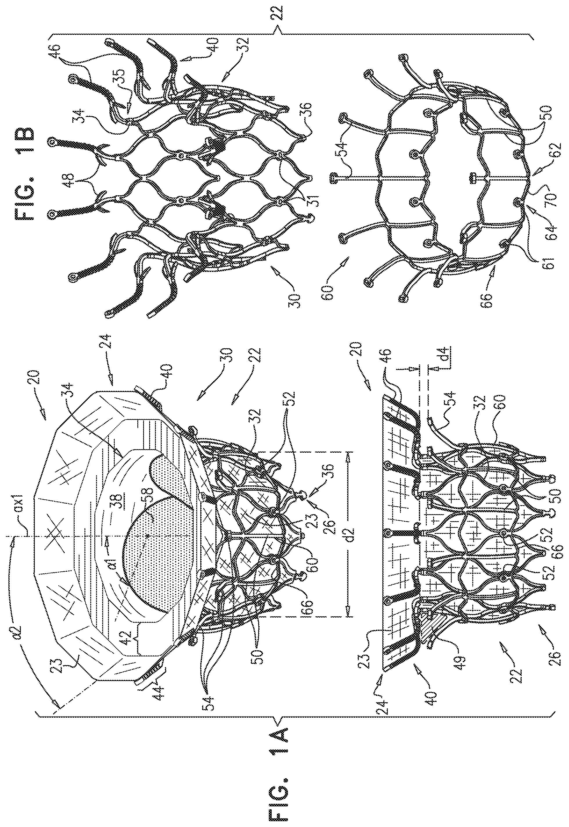 Patent US12396851 — Prosthetic valve with arms and flanges — Figure 1