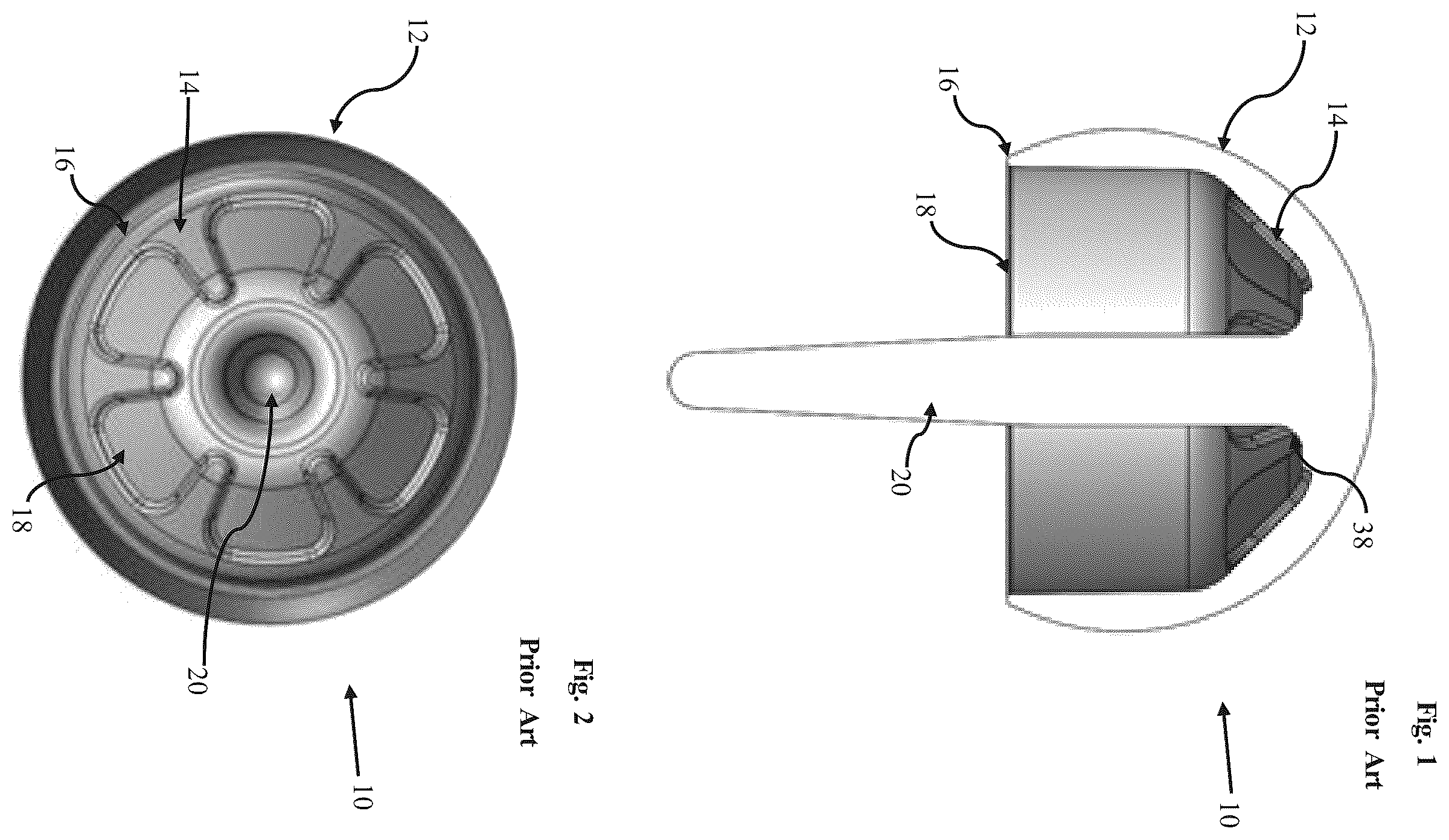 Patent US12396856 — Ceramic femoral resurfacing head prosthesis — Figure 1