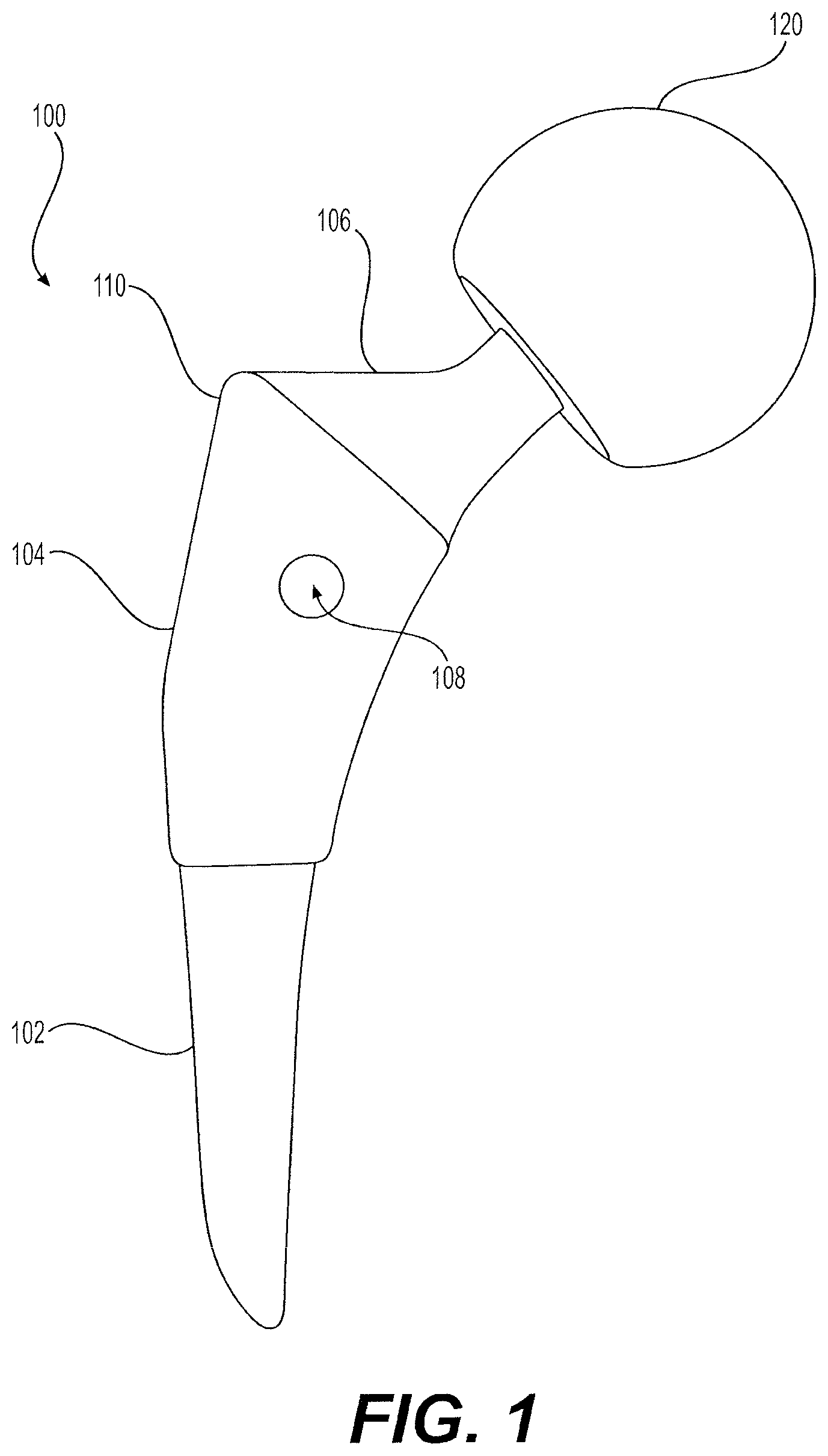Patent US12396857 — Proximally fitting femoral component with adjunctive screw fixation — Figure 1