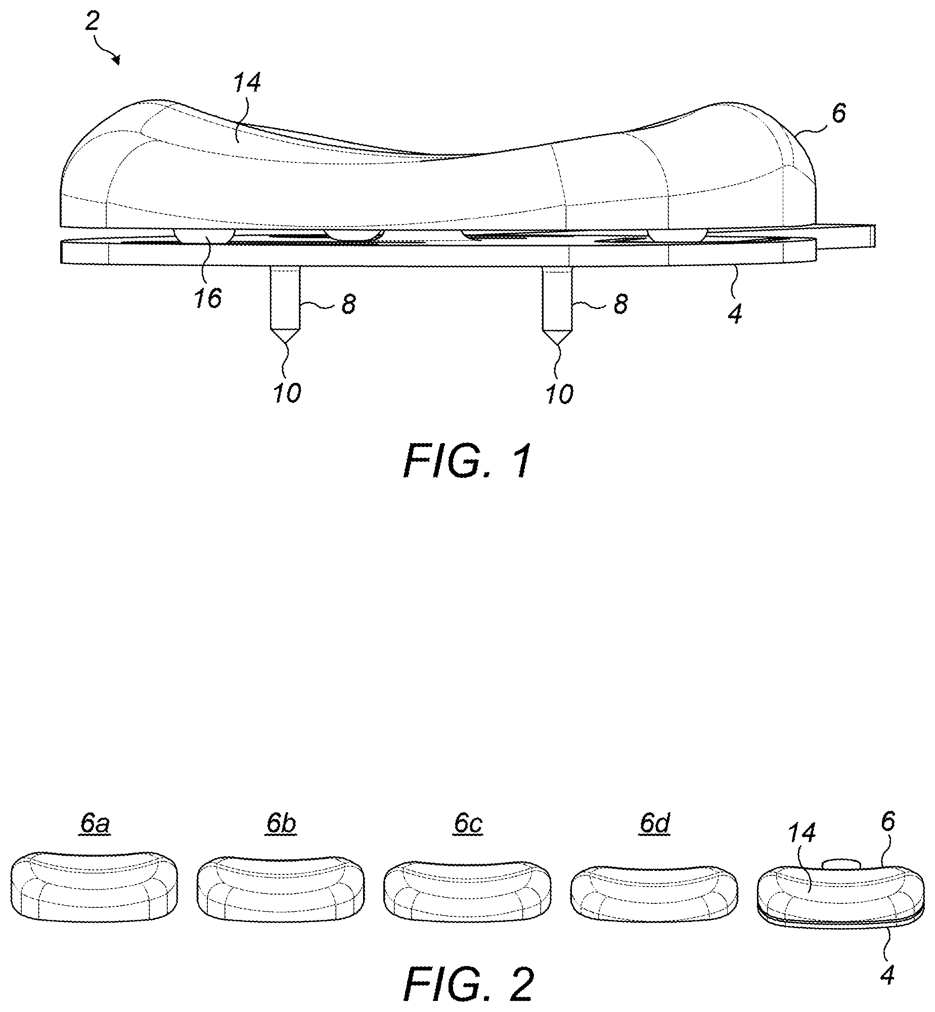 Patent US12396859 — Trial patella component kit — Figure 1