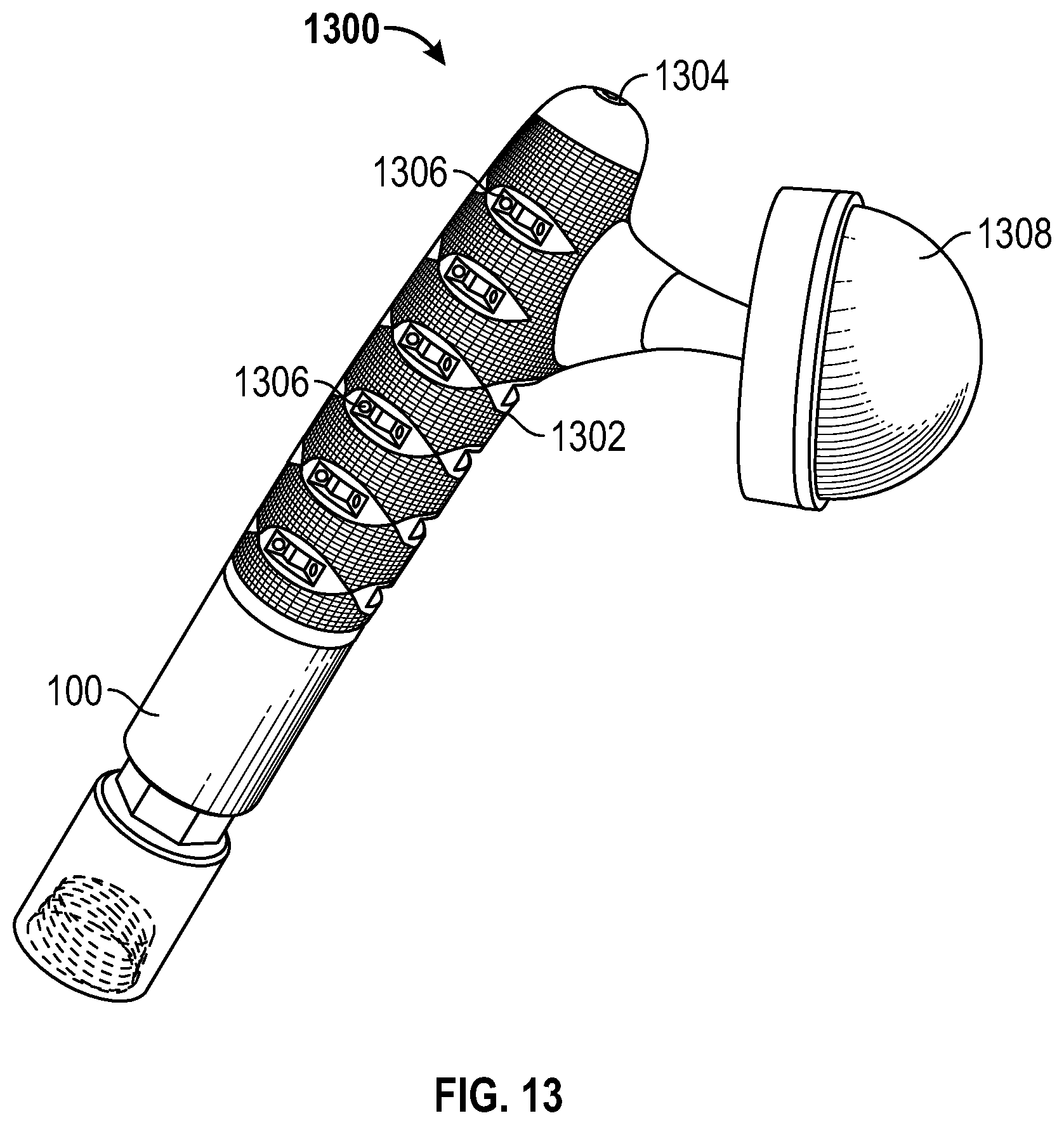 Patent US12396860 Figure 9 – Modular rotational device for torsionally stabilizing an endoprosthesis