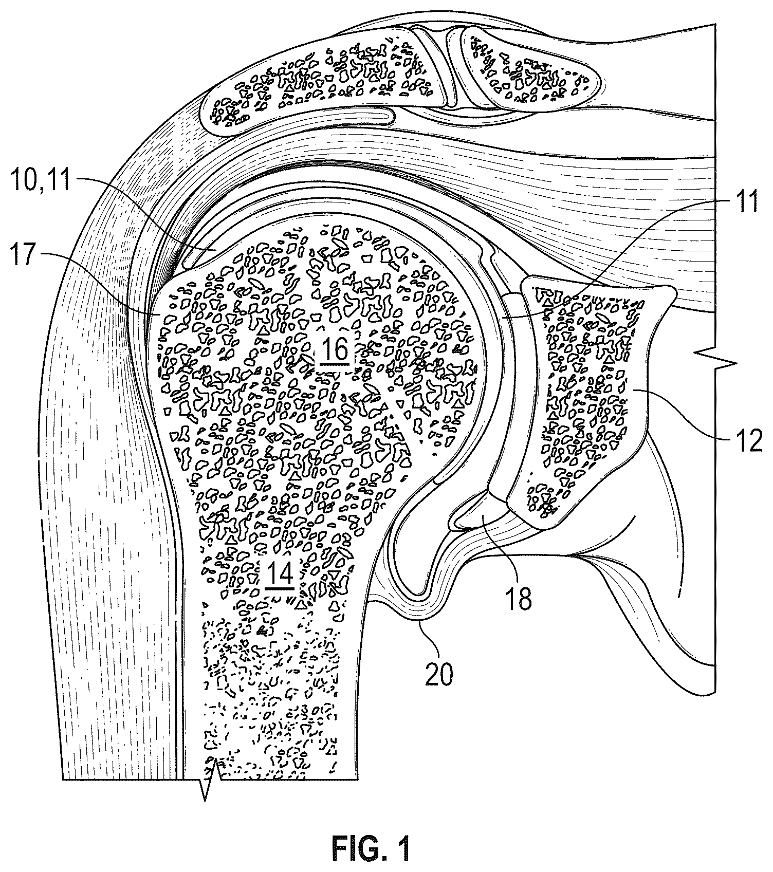 Patent US12396869 — Systems and methods for using image analysis to guide a surgical procedure — Figure 1