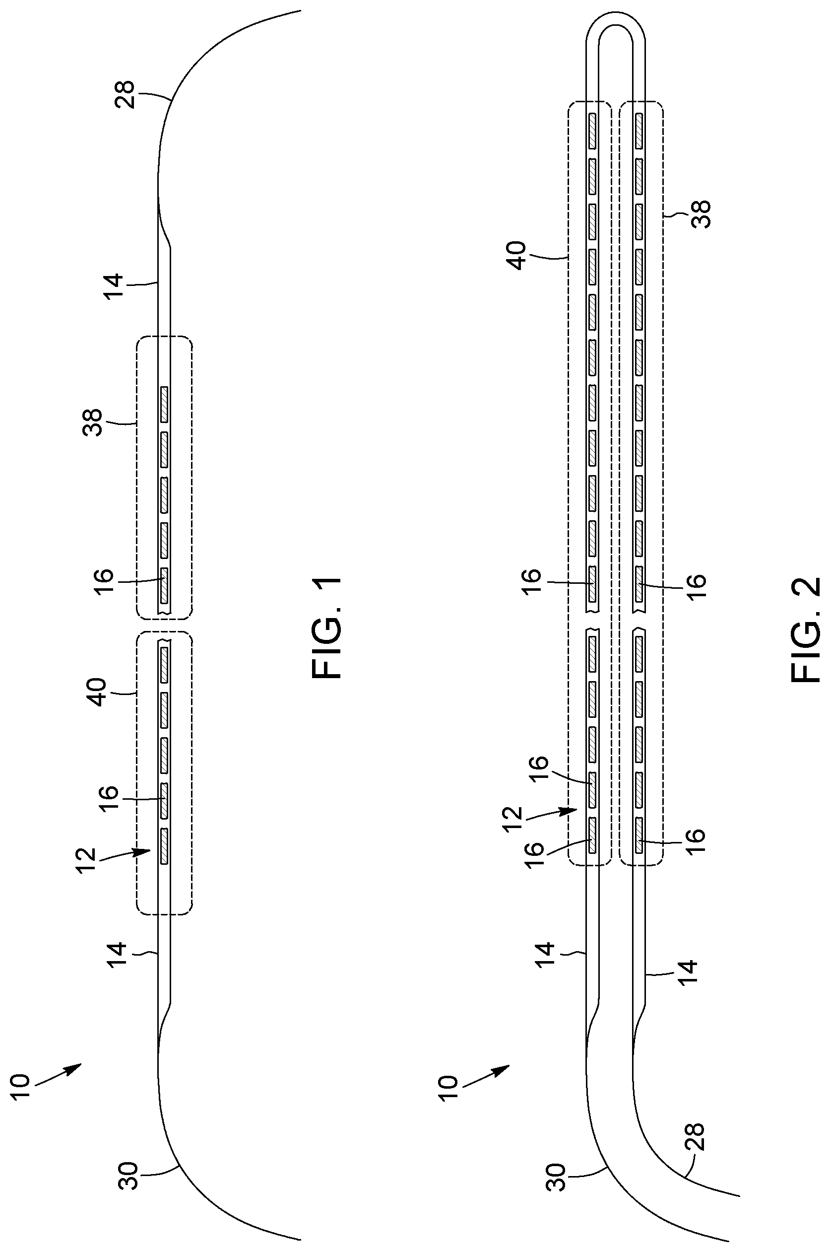 Patent US12396874 — Magnetic devices for digestive tract partitioning — Figure 1
