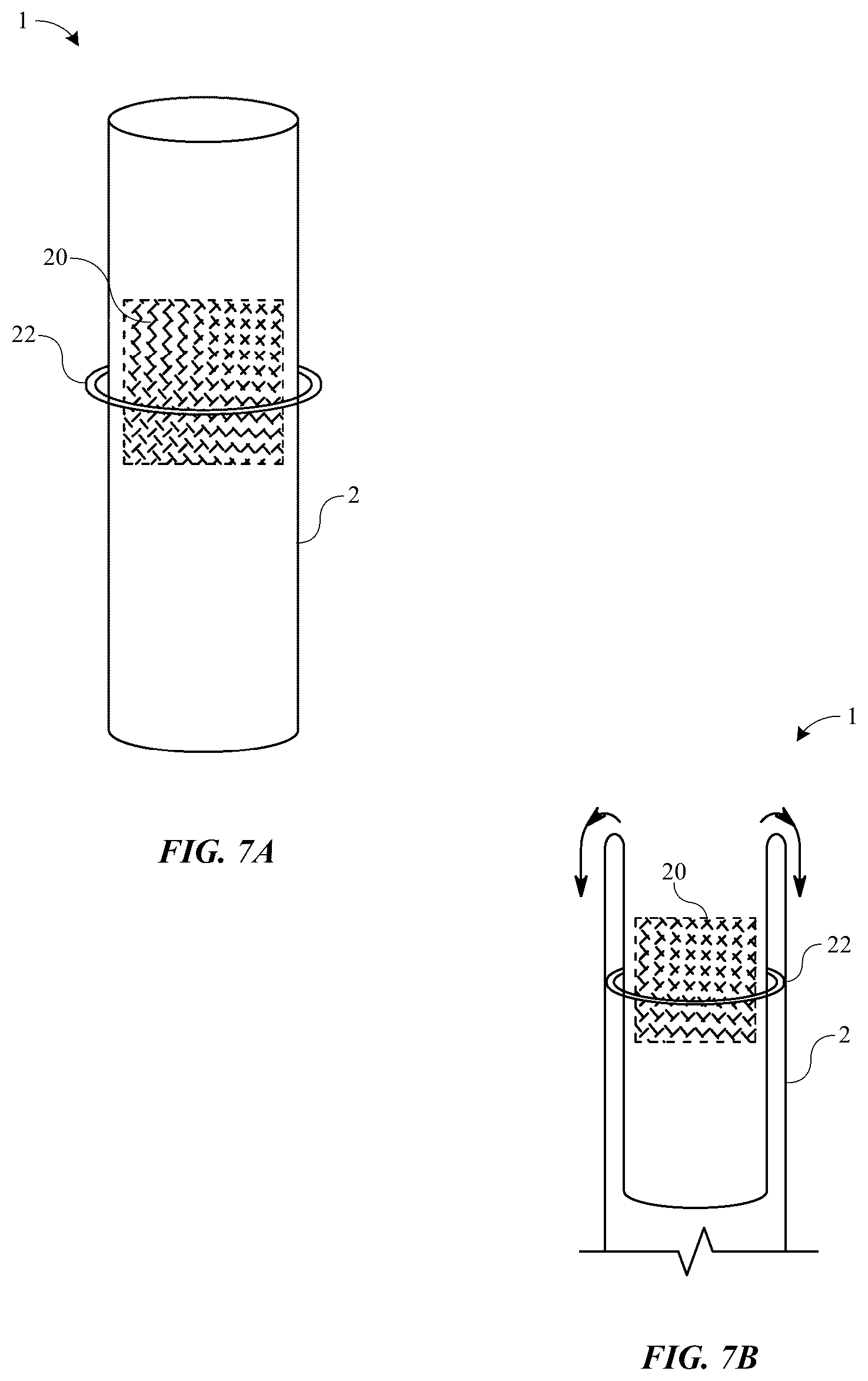 Patent US12396881 Figure 6 – Wearable urinary collection apparatus