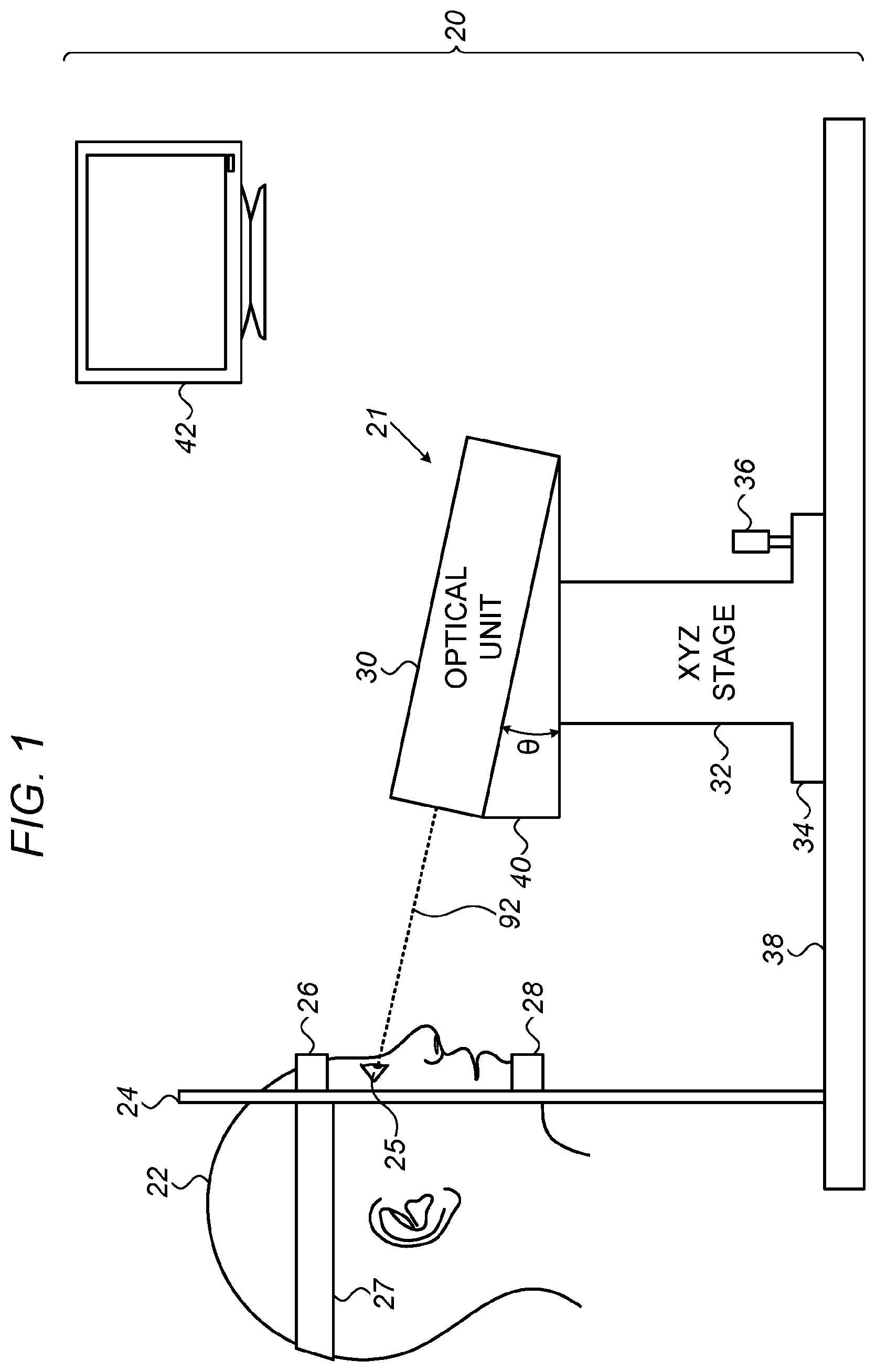 Patent US12396886 — Automated capsulotomy — Figure 1