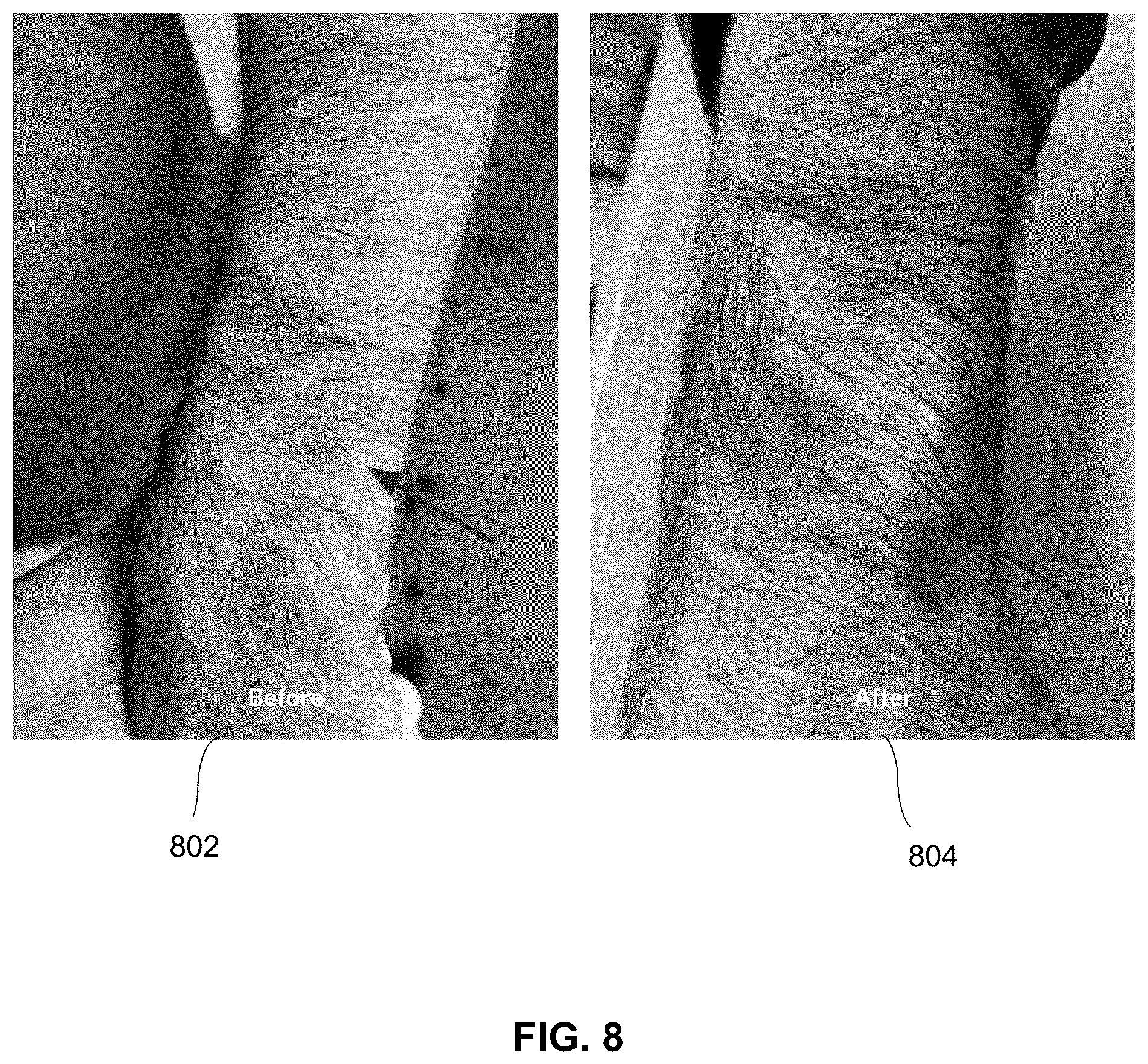 Patent US12396973 Figure 9 – Methods and chemical compositions for treating skin conditions by providing long lasting skin PH control for improving skin barrier function