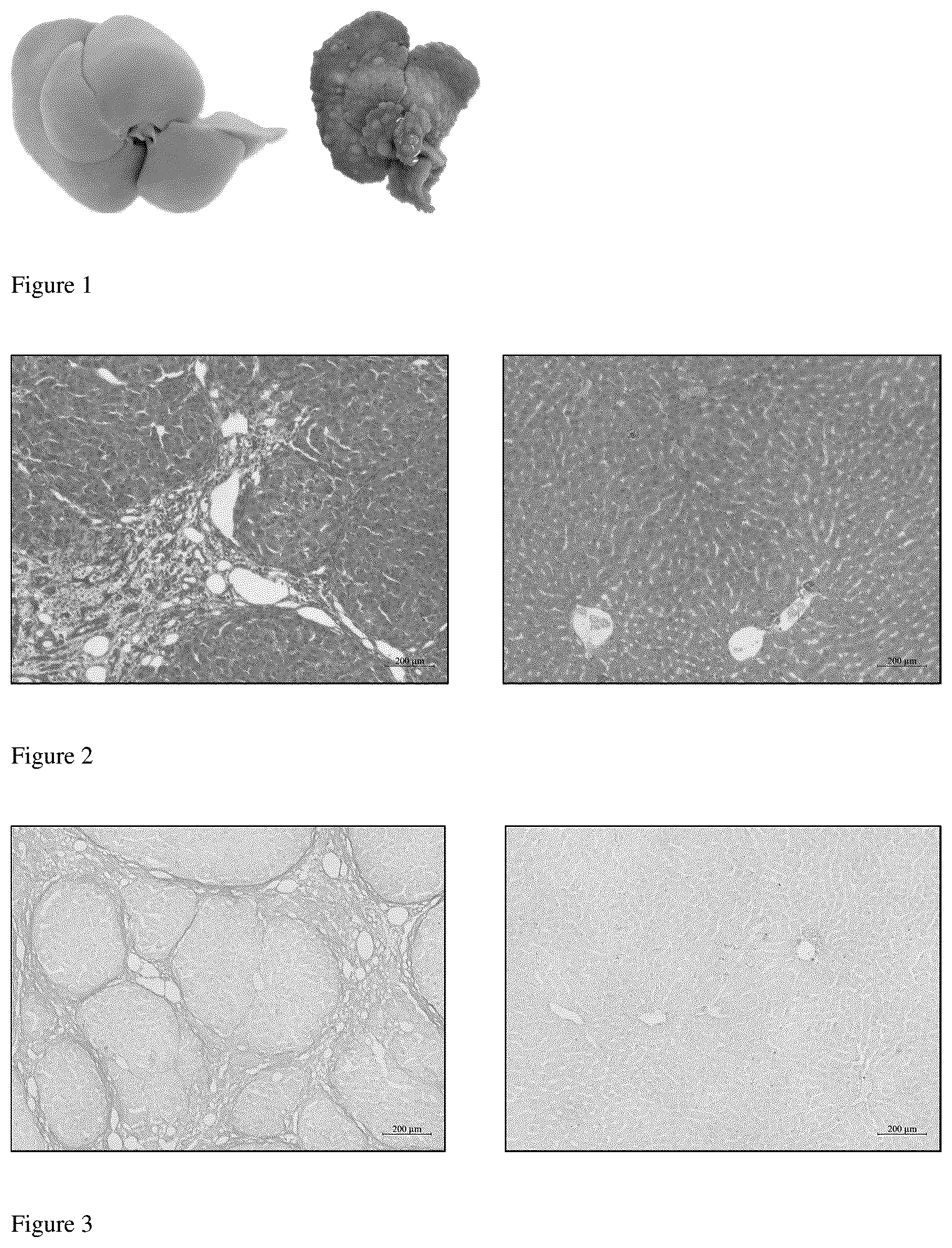 Patent US12396990 Figure 1 – Application of 5-hydroxytryptamine receptor 1A in preparing drug for portal hypertension