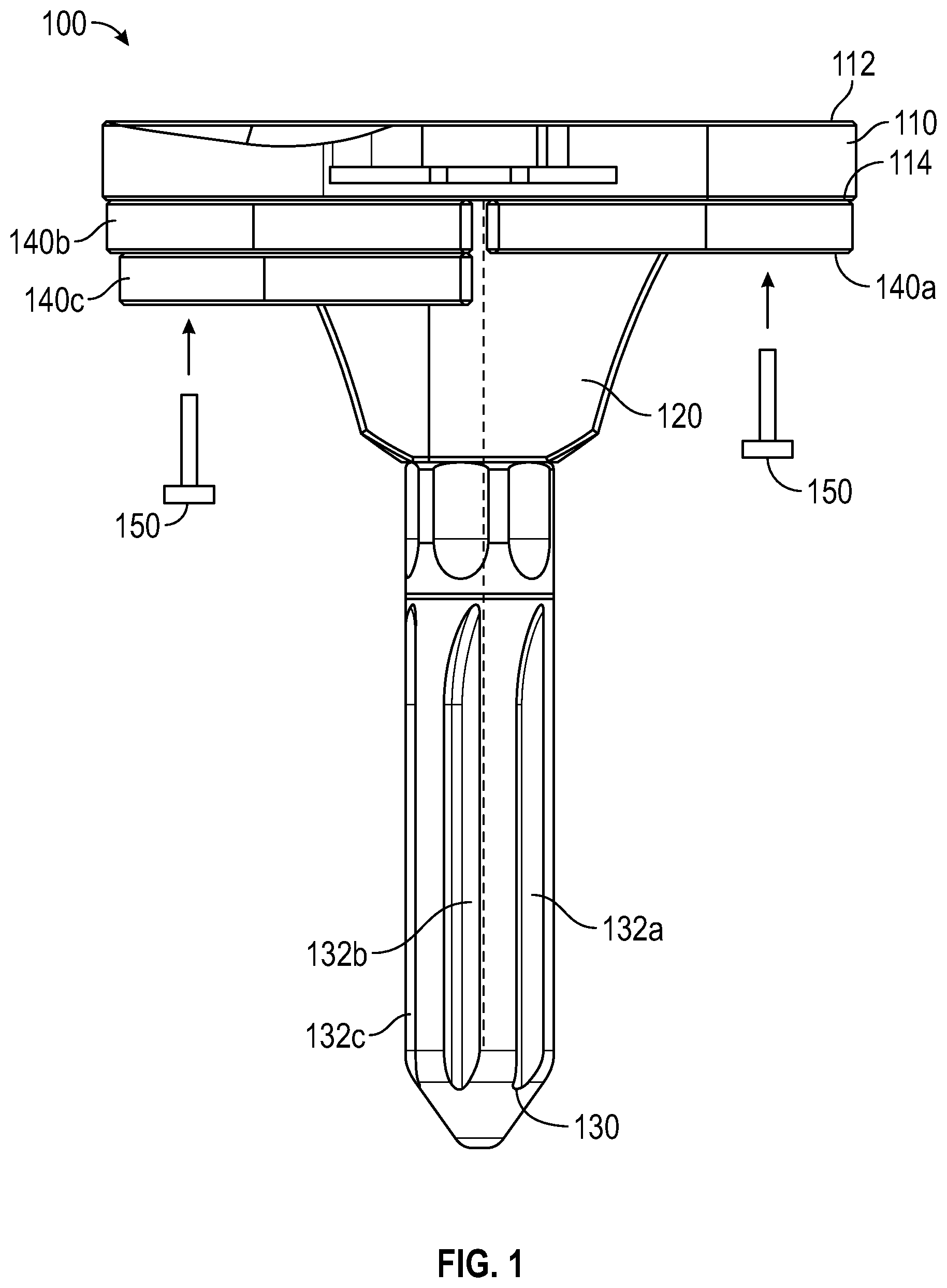 Patent US12403010 — Knee replacement implant having stackable spacers — Figure 1