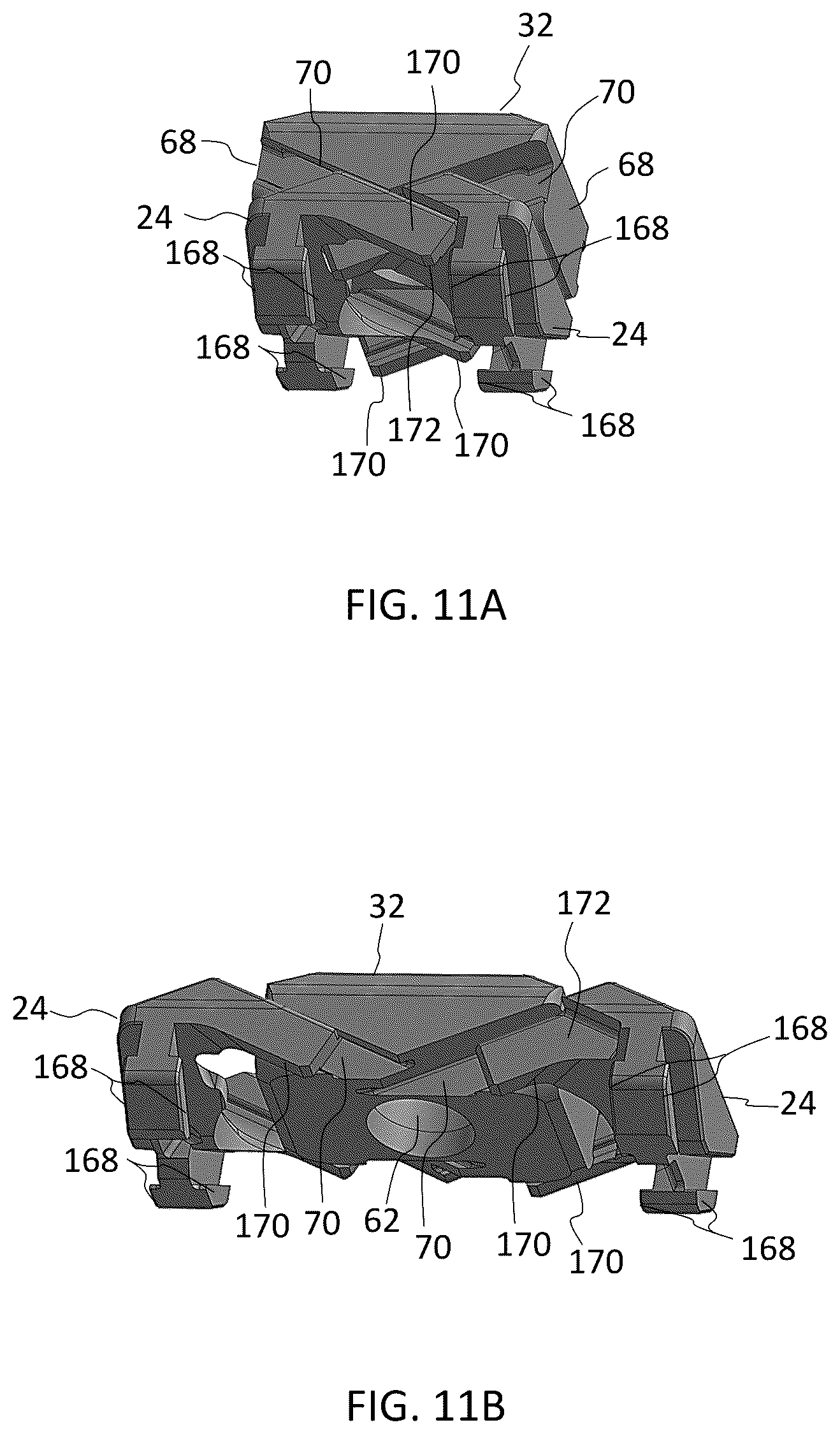 Patent US12403017 Figure 10 – Expandable footprint implant