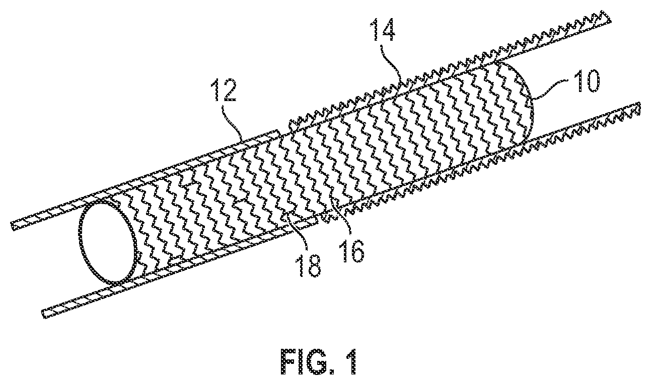 Patent US12403024 Figure 1 – Vascular and aortic grafts with telescoping sheath and deployment methods thereof